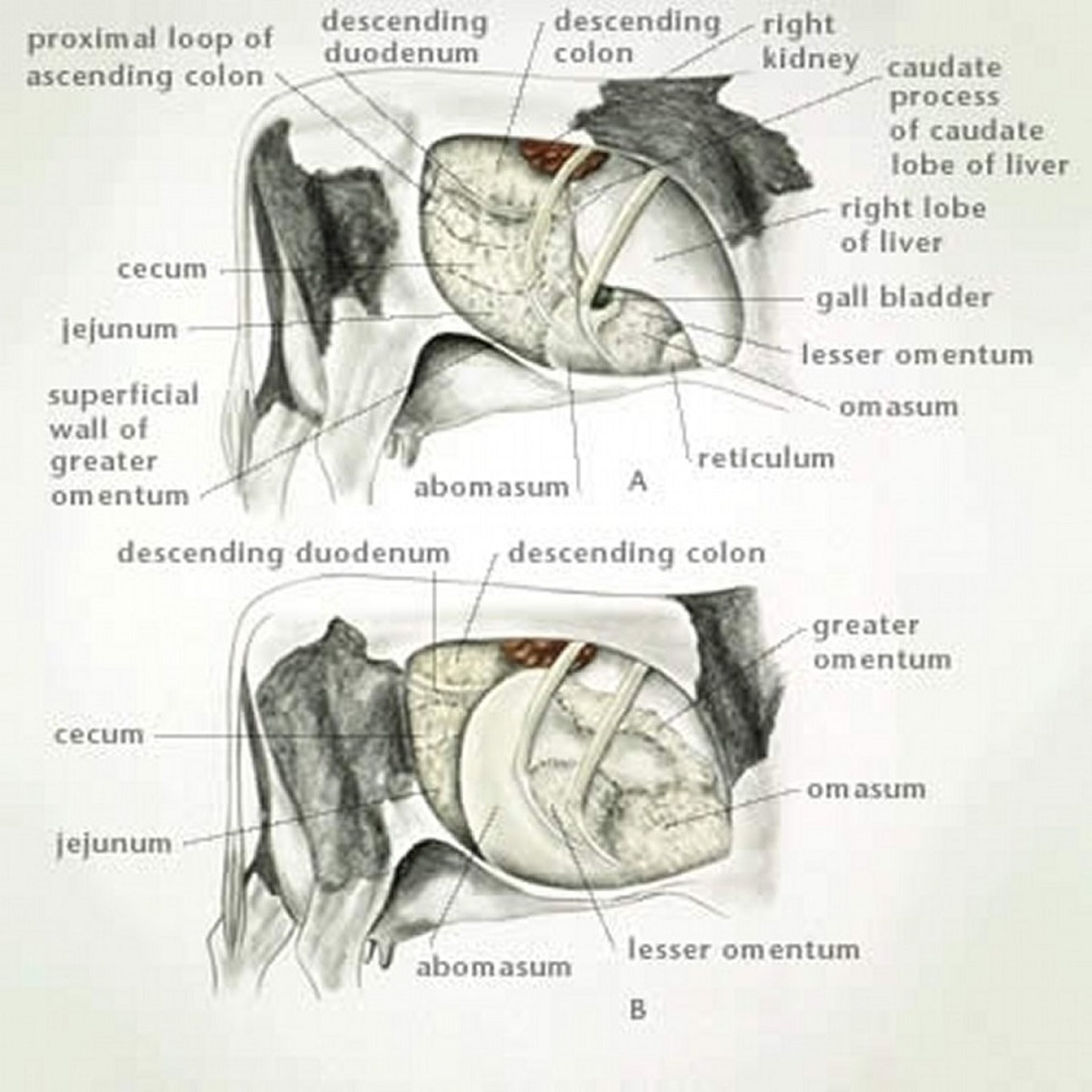 Right displaced abomasum with volvulus, cow