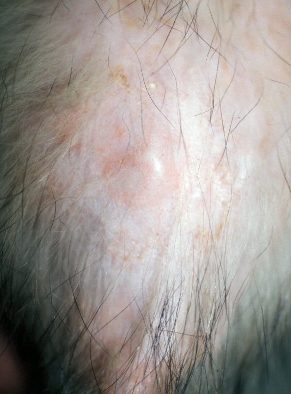 Ringworm lesions, ferret