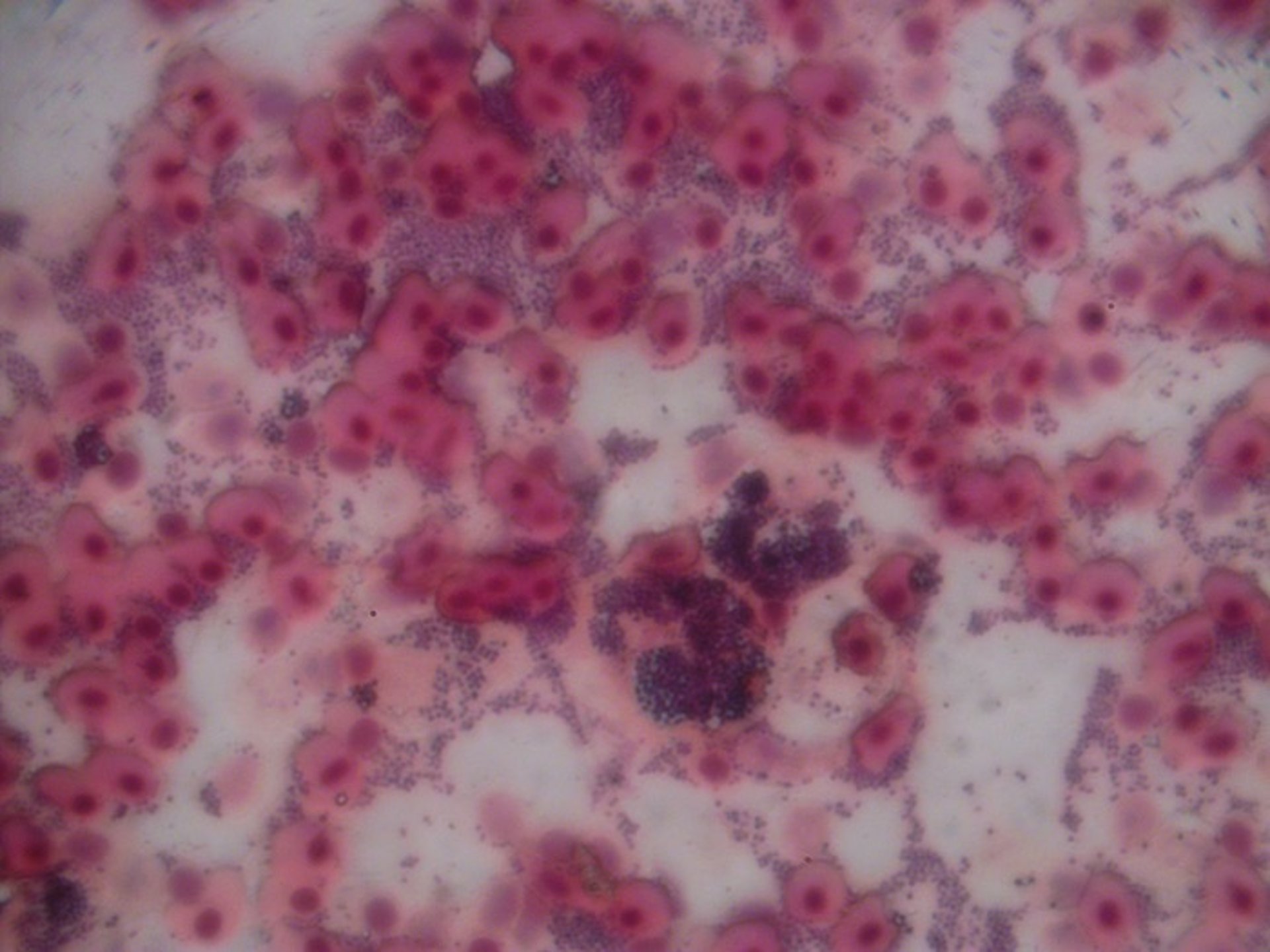 Gram-stained touch impression of spleen, redtail shark (<i >Epalzeorhynchus bicolor</i>)
