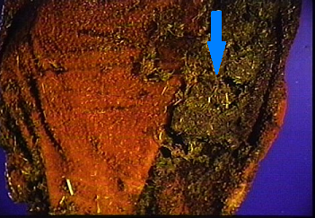 Bovine Rument Image:Rumen sloughing, bovine-Merck Veterinary Manual