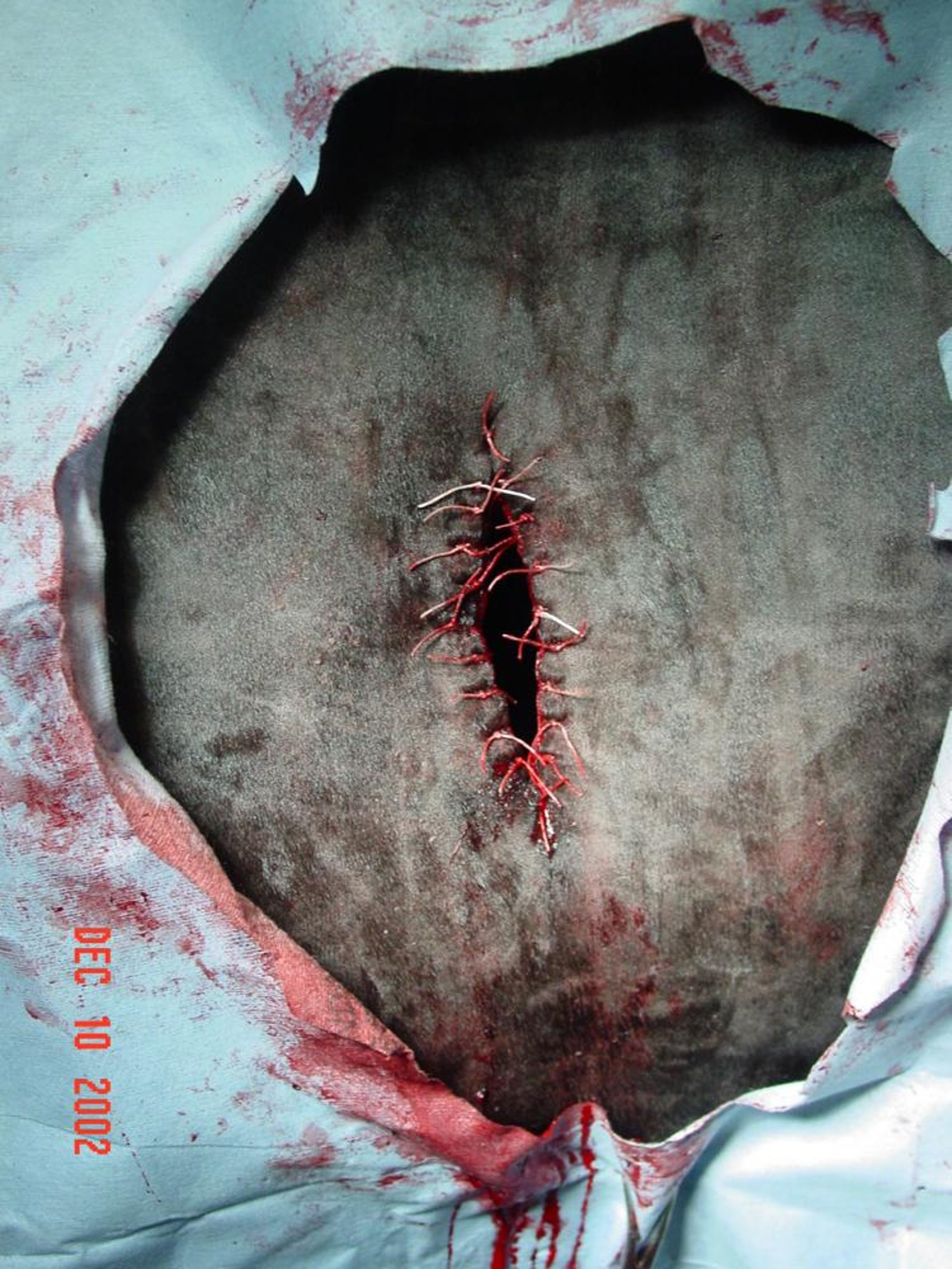 Rumenostomy, cow