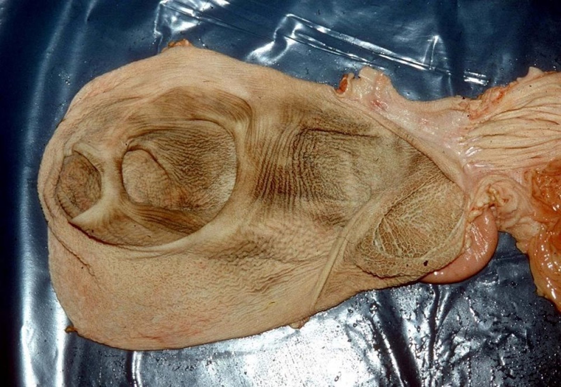 Ruminal mucosa, calf