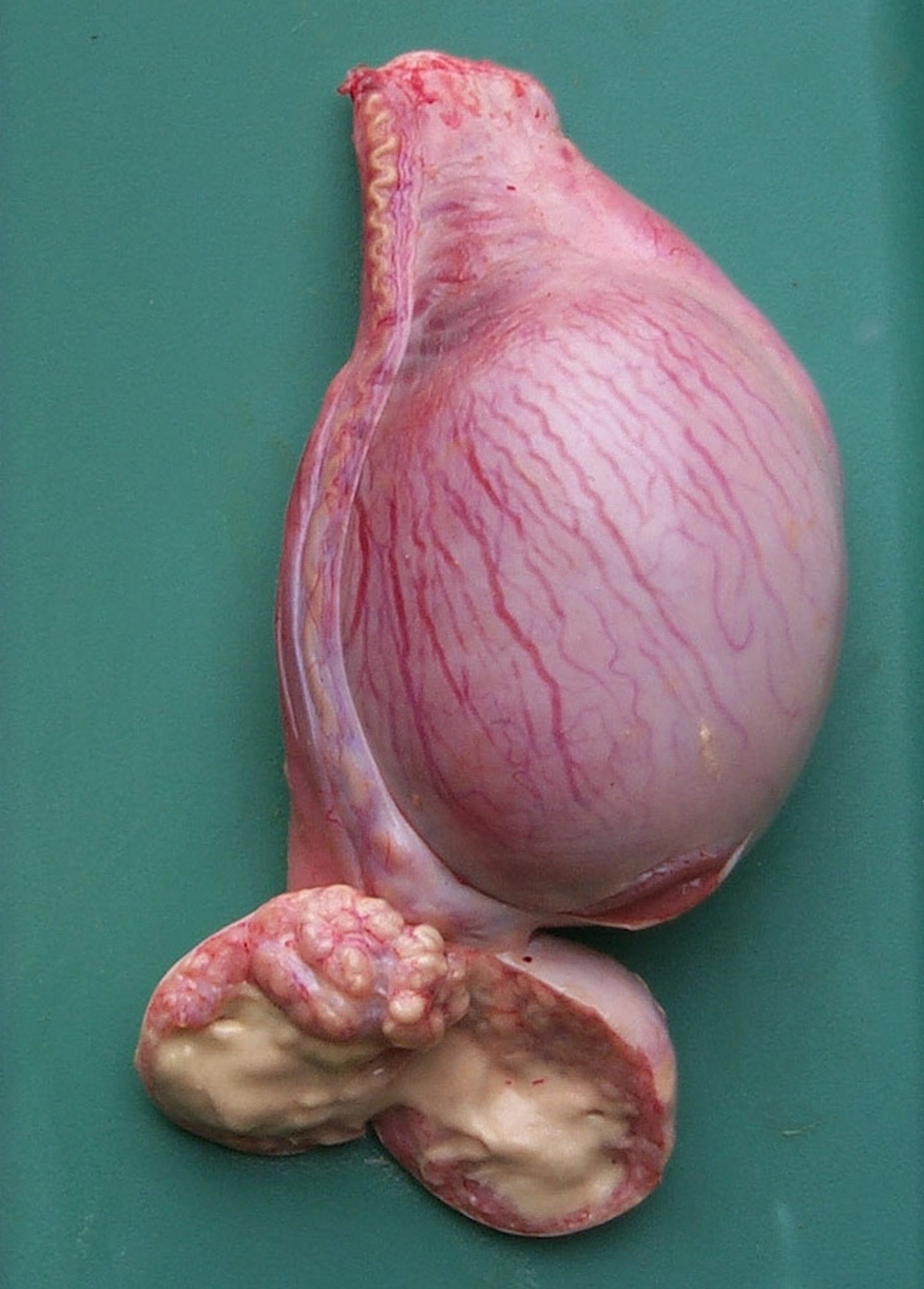 Epididimitis, carnero