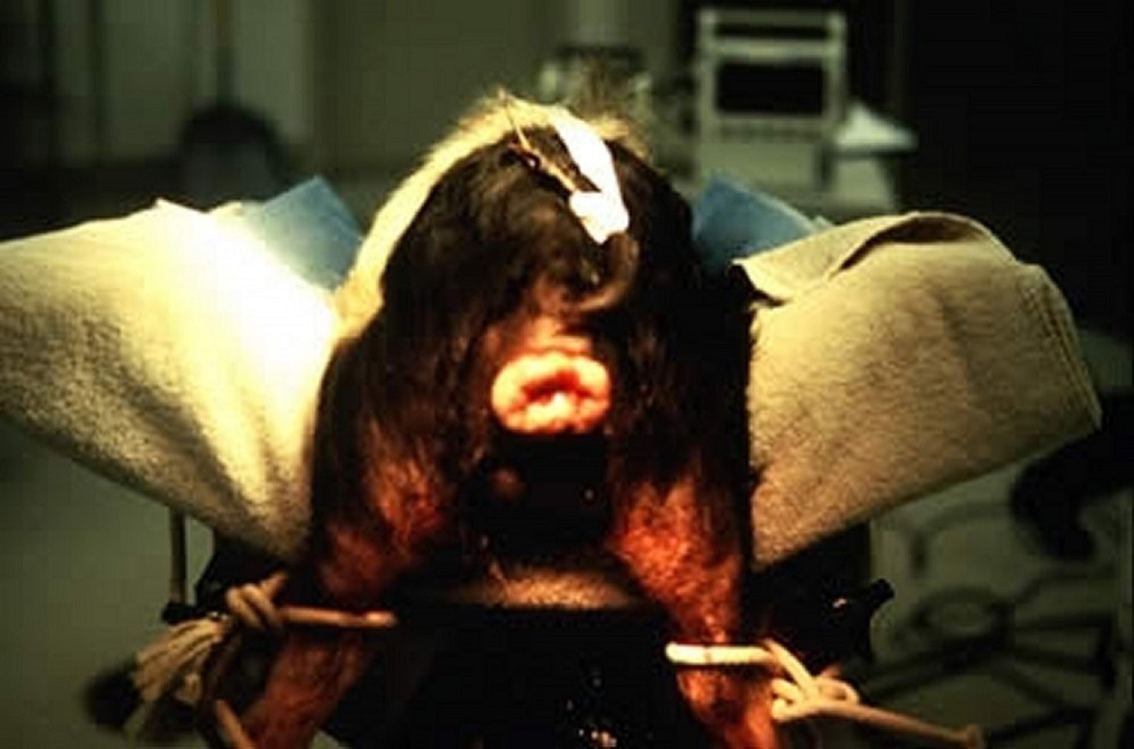 Prolapso rectal, cerdo miniatura