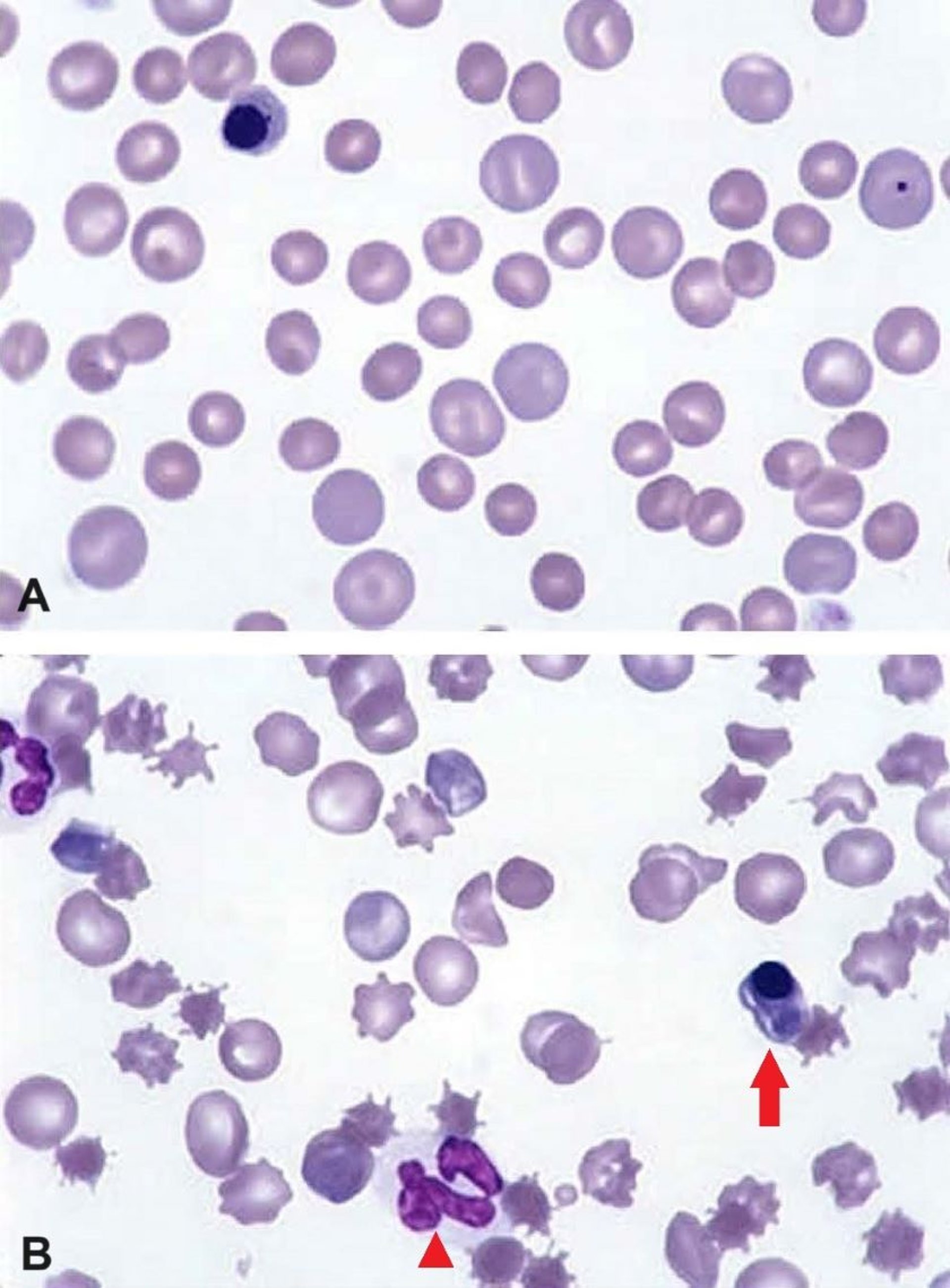 Anemia regenerativa, frotis sanguíneos, perro