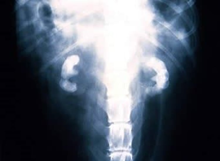 Renal calculi, radiograph, dog