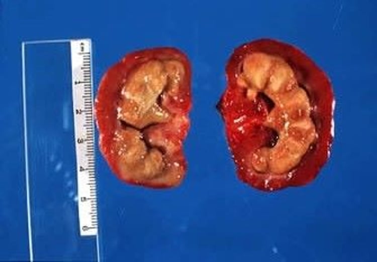 Renal calculus, Samoyed
