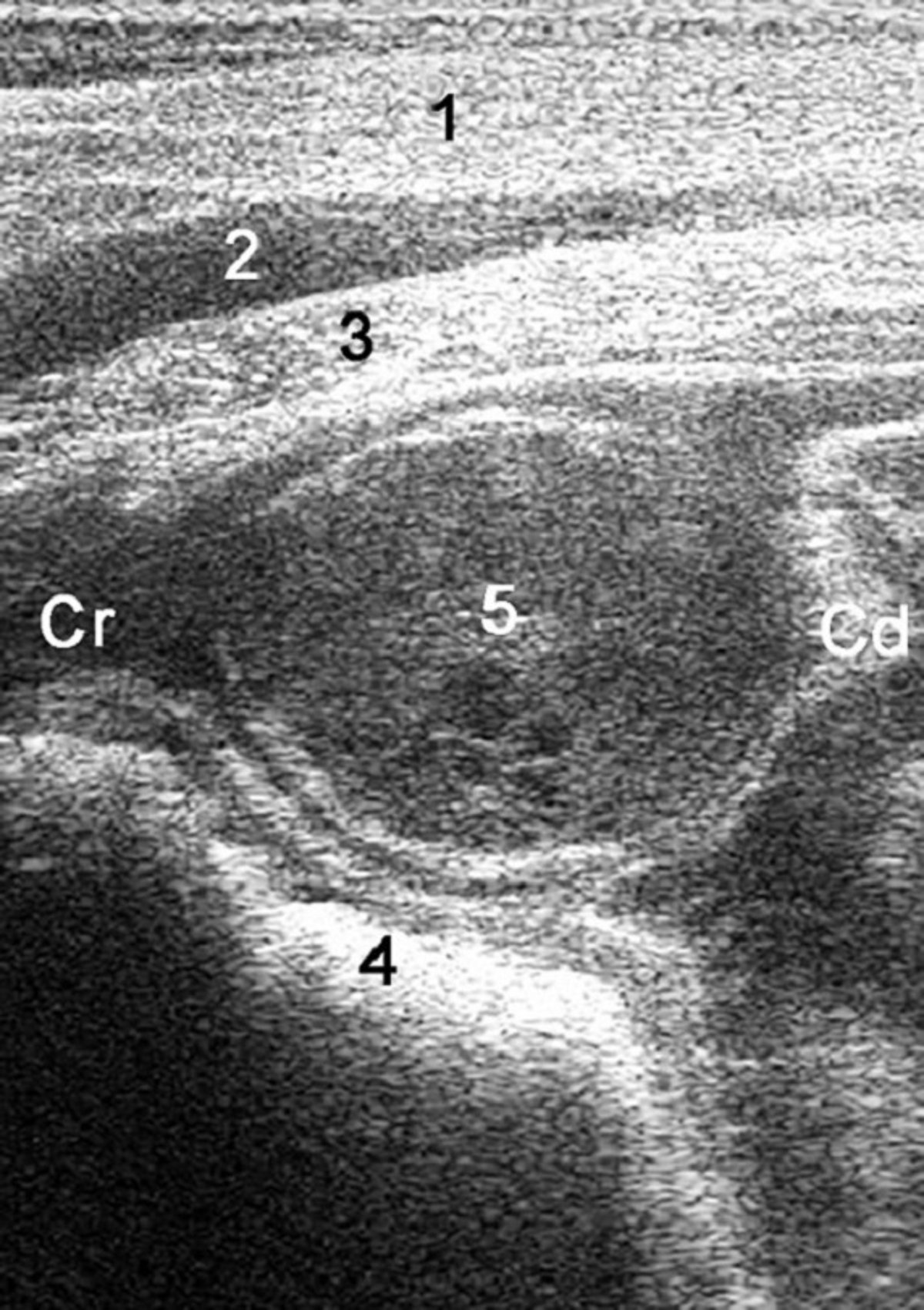 Absceso reticular en la reticuloperitonitis traumática, vaca