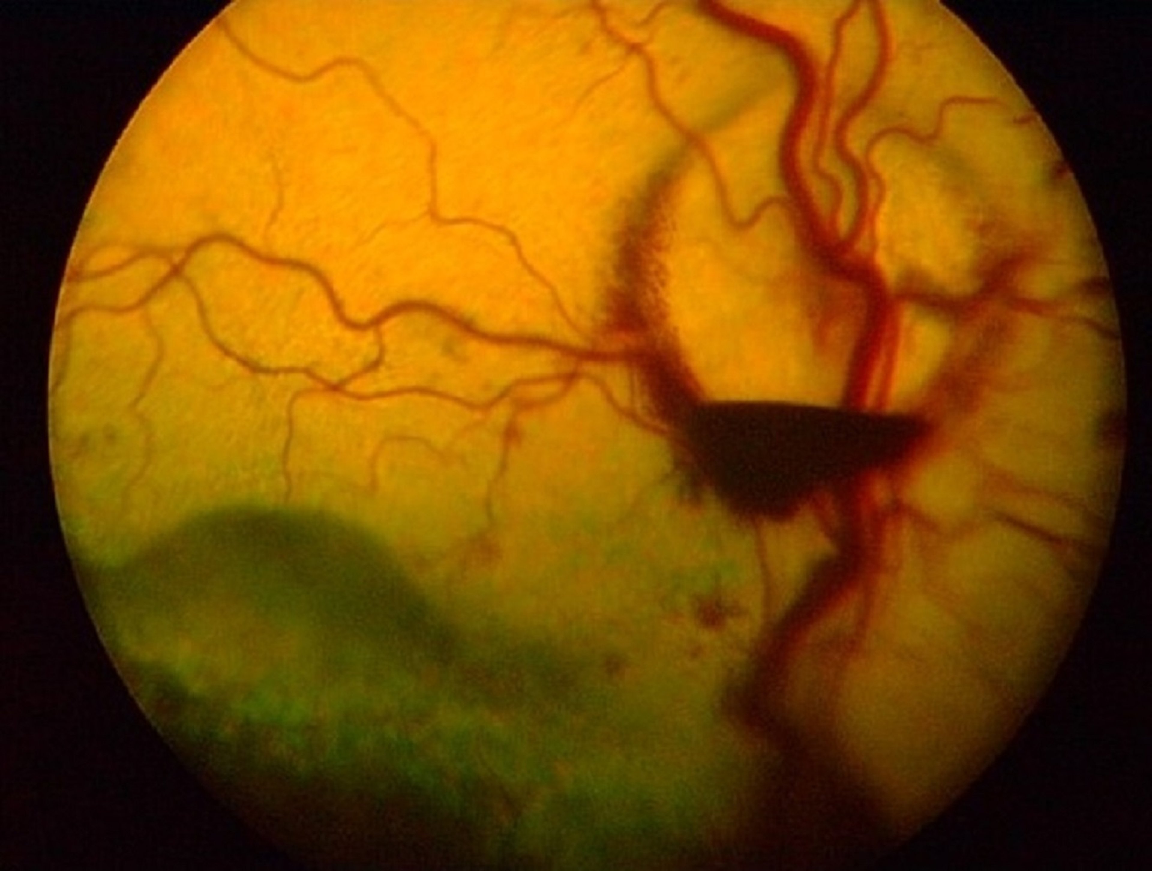 Hemorragia e descolamento de retina secundários a hipertensão sistêmica, cão