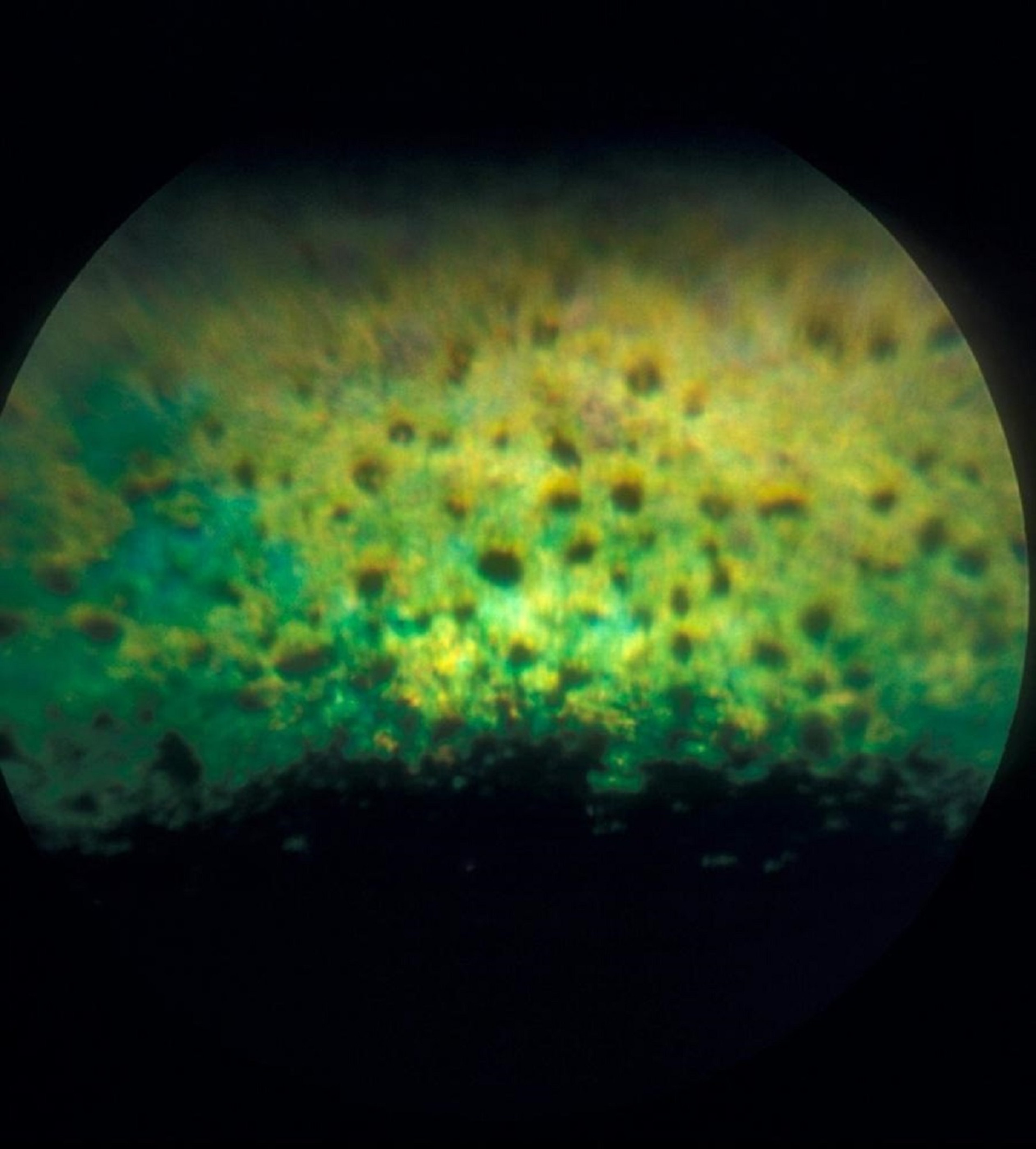 Distrofia del epitelio pigmentario de la retina, perro