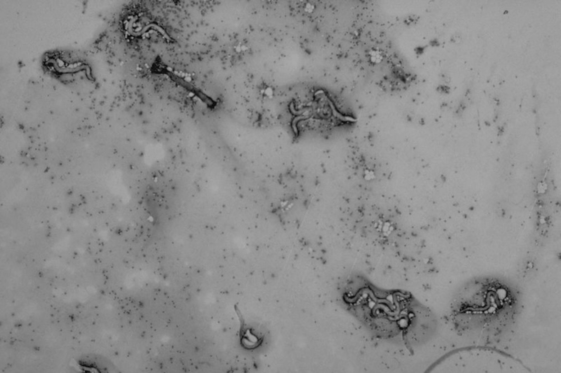 <i >Rhabdias</i> larvae in lung lavage, snake