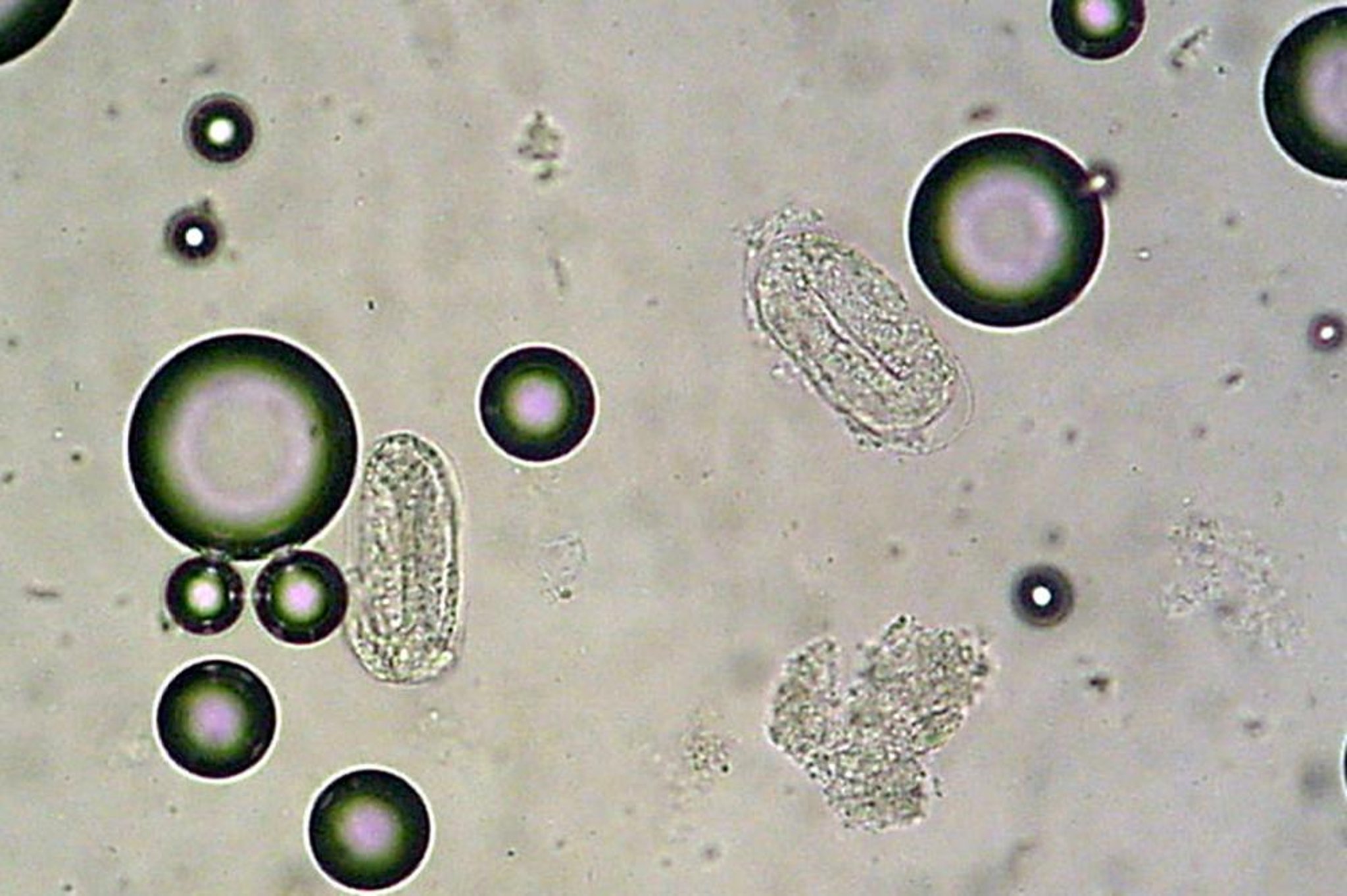 Óvulos embrionados característicos de <i >Rhabdias</i> y <i >Strongyloides</i>, pitón de cabeza negra