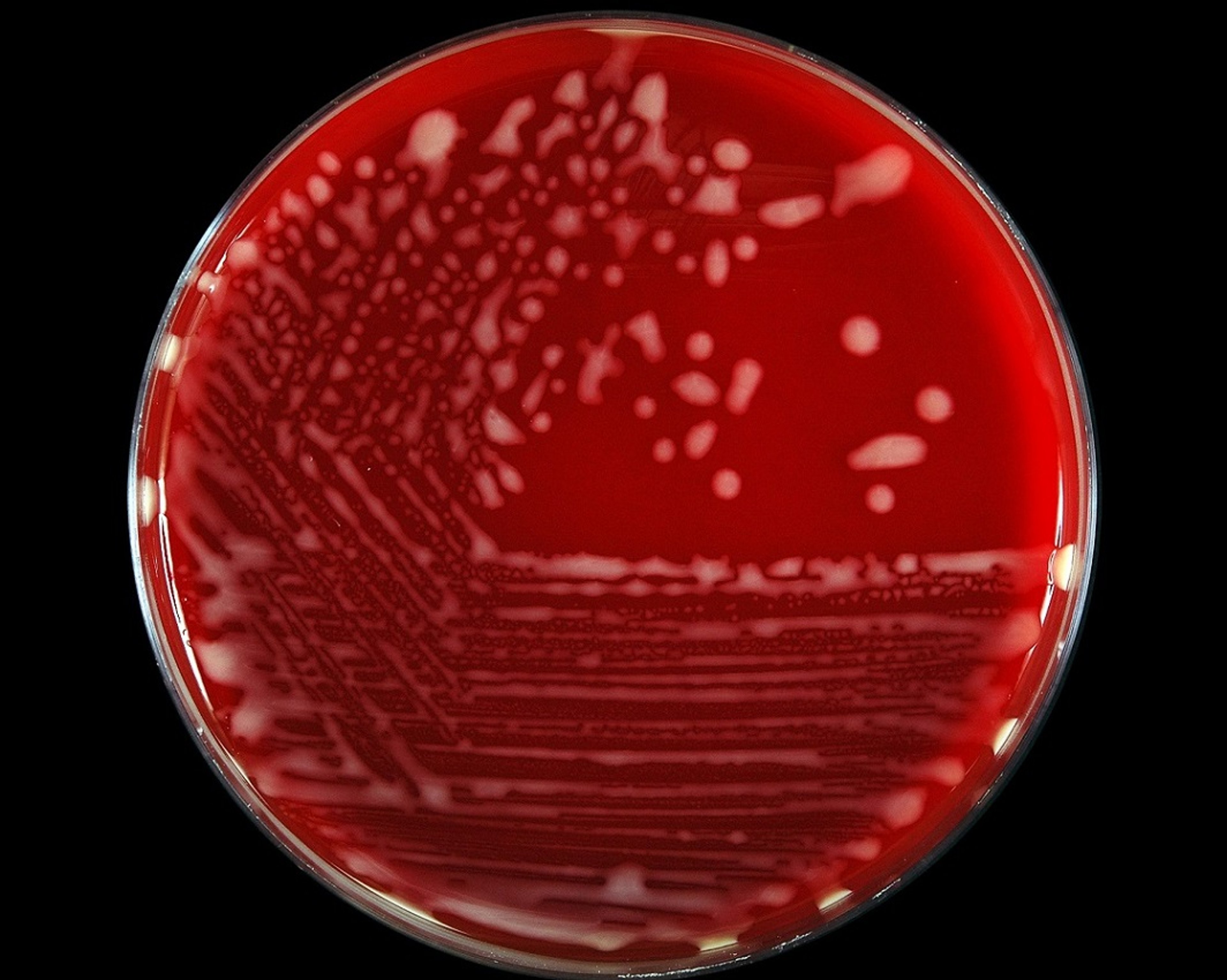 Image:Cultura de Rhodococcus equi-Manual de veterinaria de MSD