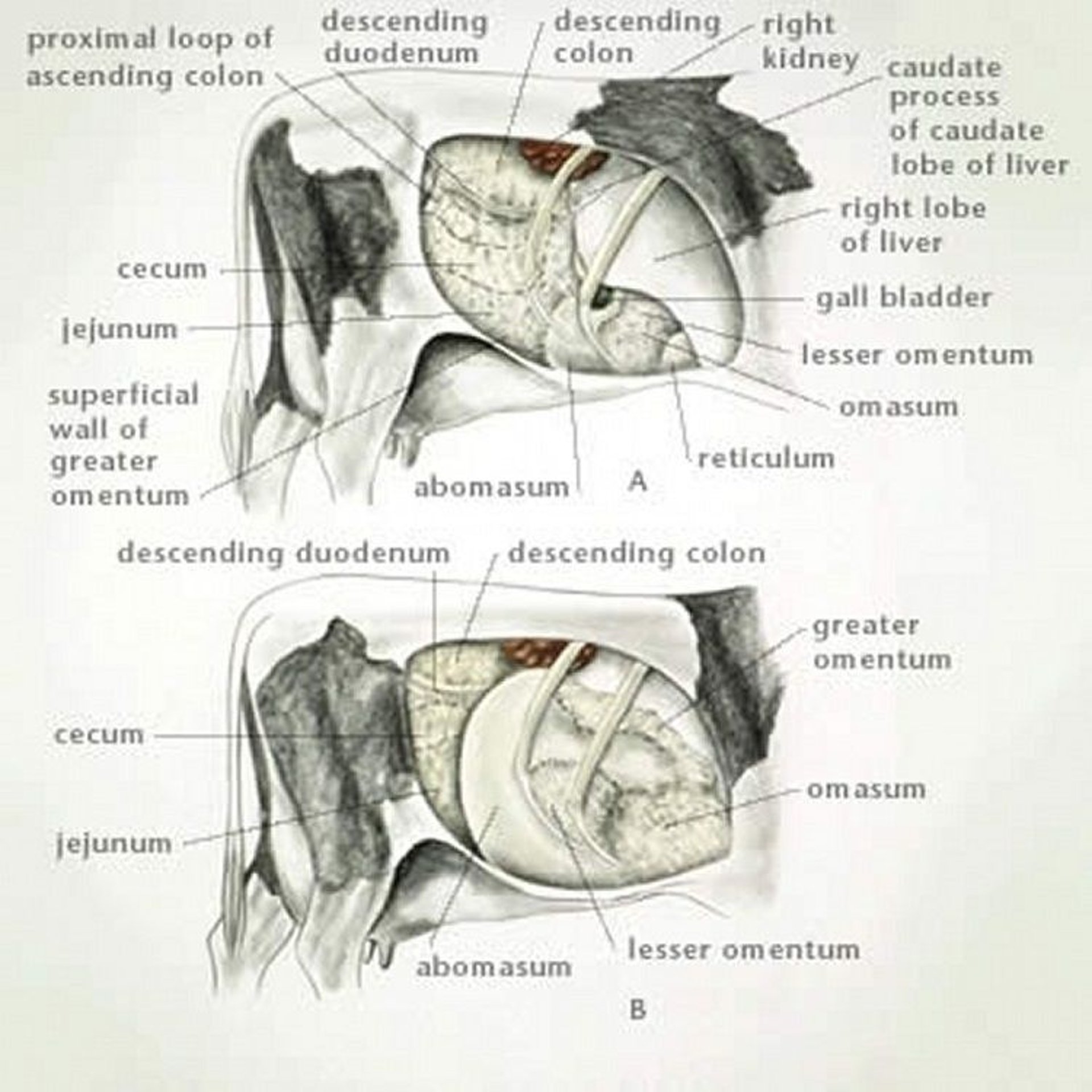 Right displaced abomasum with volvulus, cow