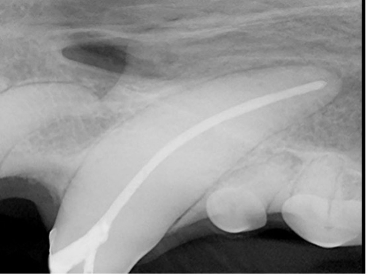 Terapia do canal radicular, cão