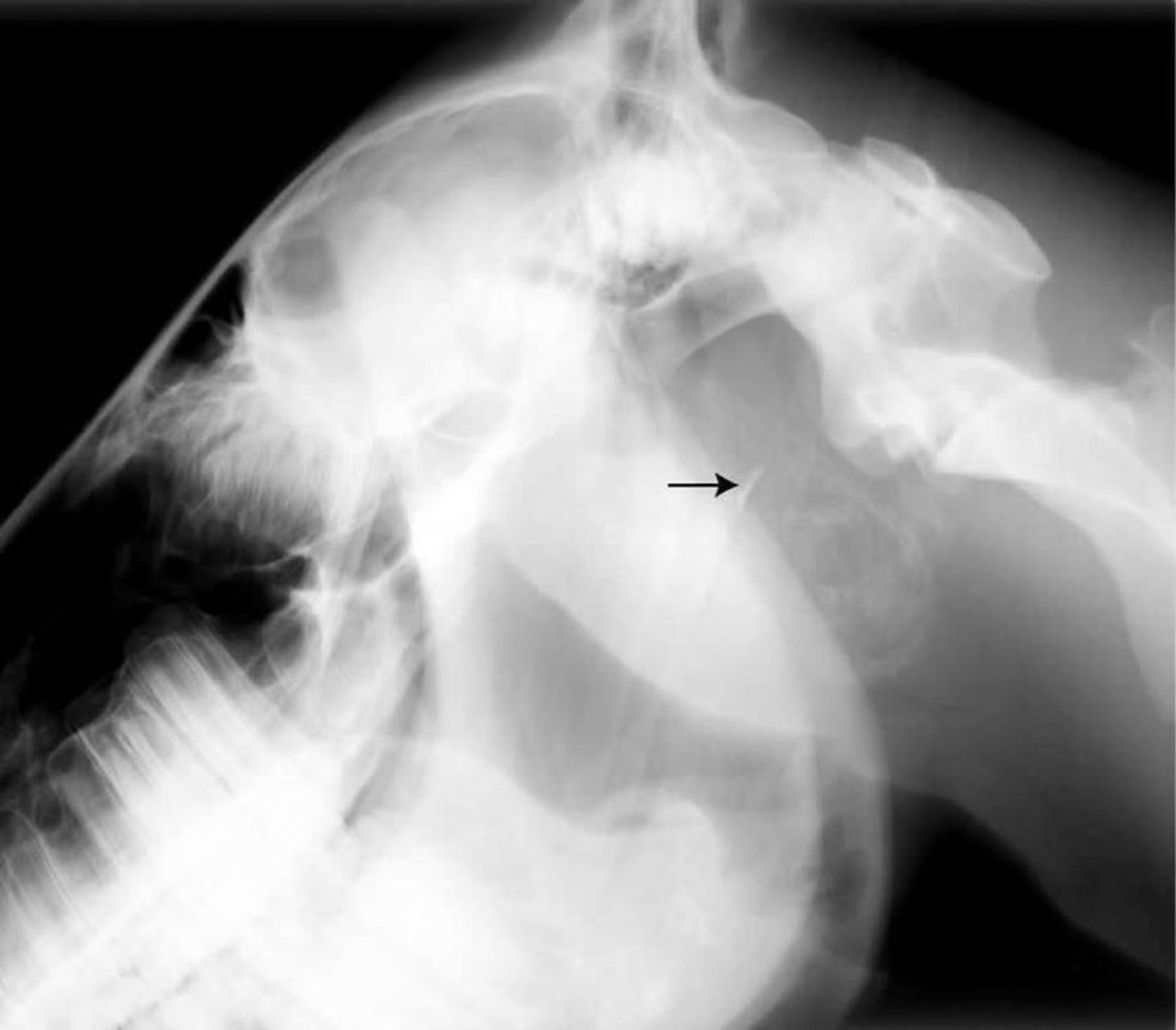 Rupture of longus capitis muscle, radiograph, horse