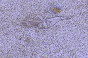 Schistosoma nasale