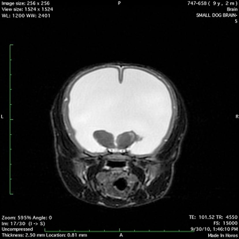 Hydrocephalus, dog (MRI)
