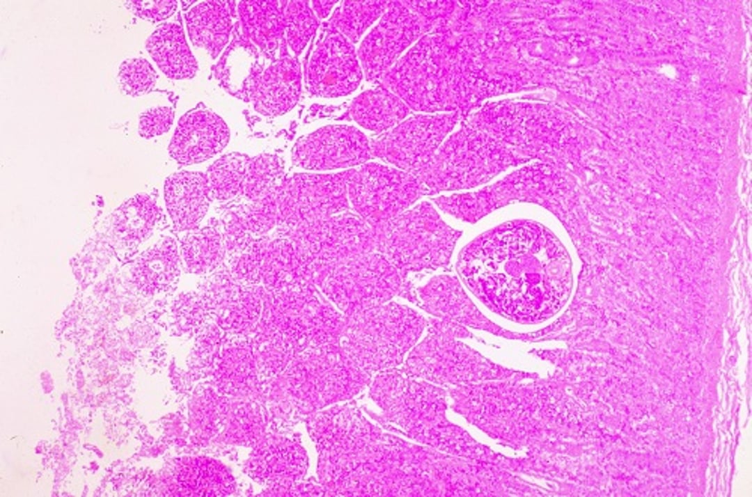 Salmon poisoning disease, small intestine, dog