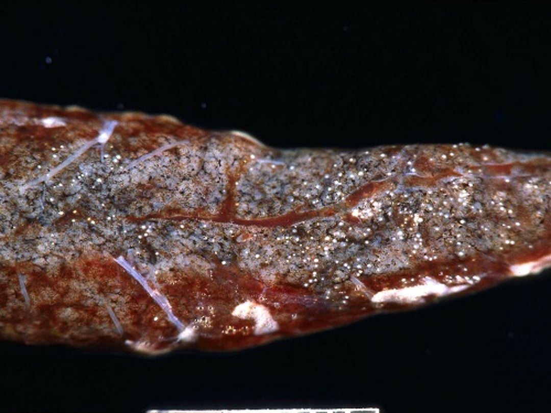 Salmon poisoning disease, trematode