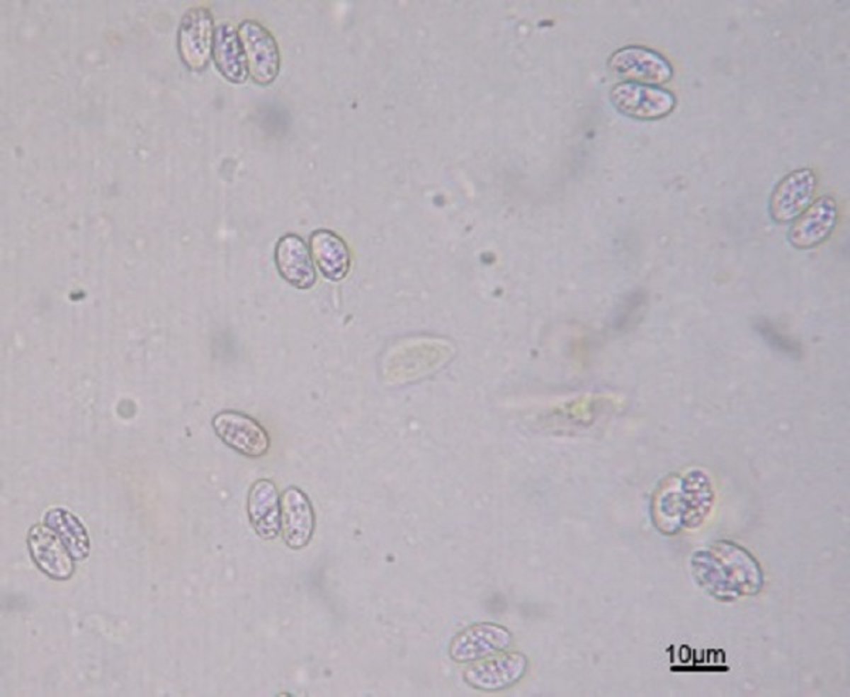 <i >Sarcocystis</i> spp oocysts and sporocysts observed by sugar flotation