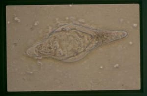 Schistosoma bovis egg