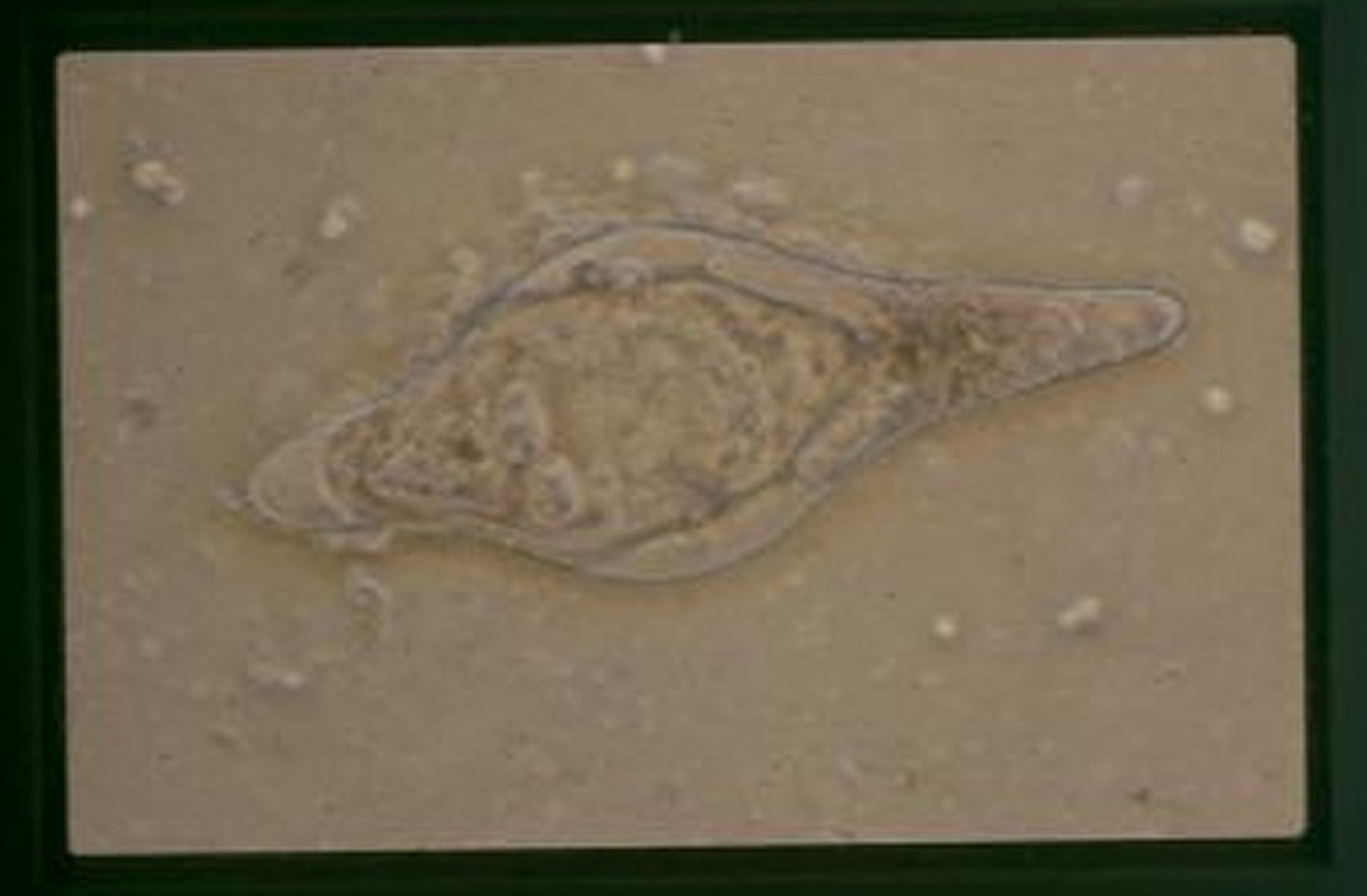 <i >Schistosoma bovis</i> egg