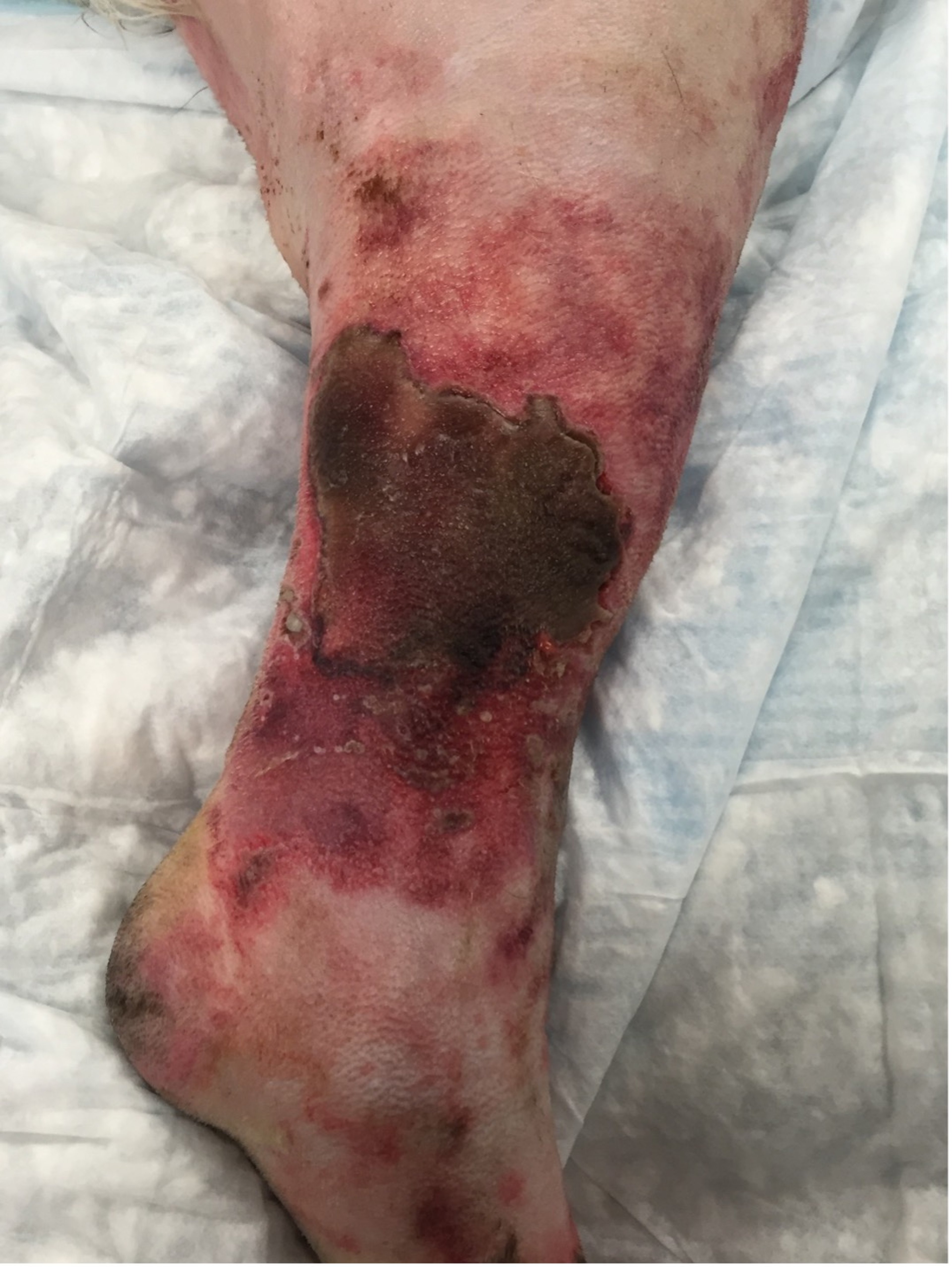Skin necrosis, dog