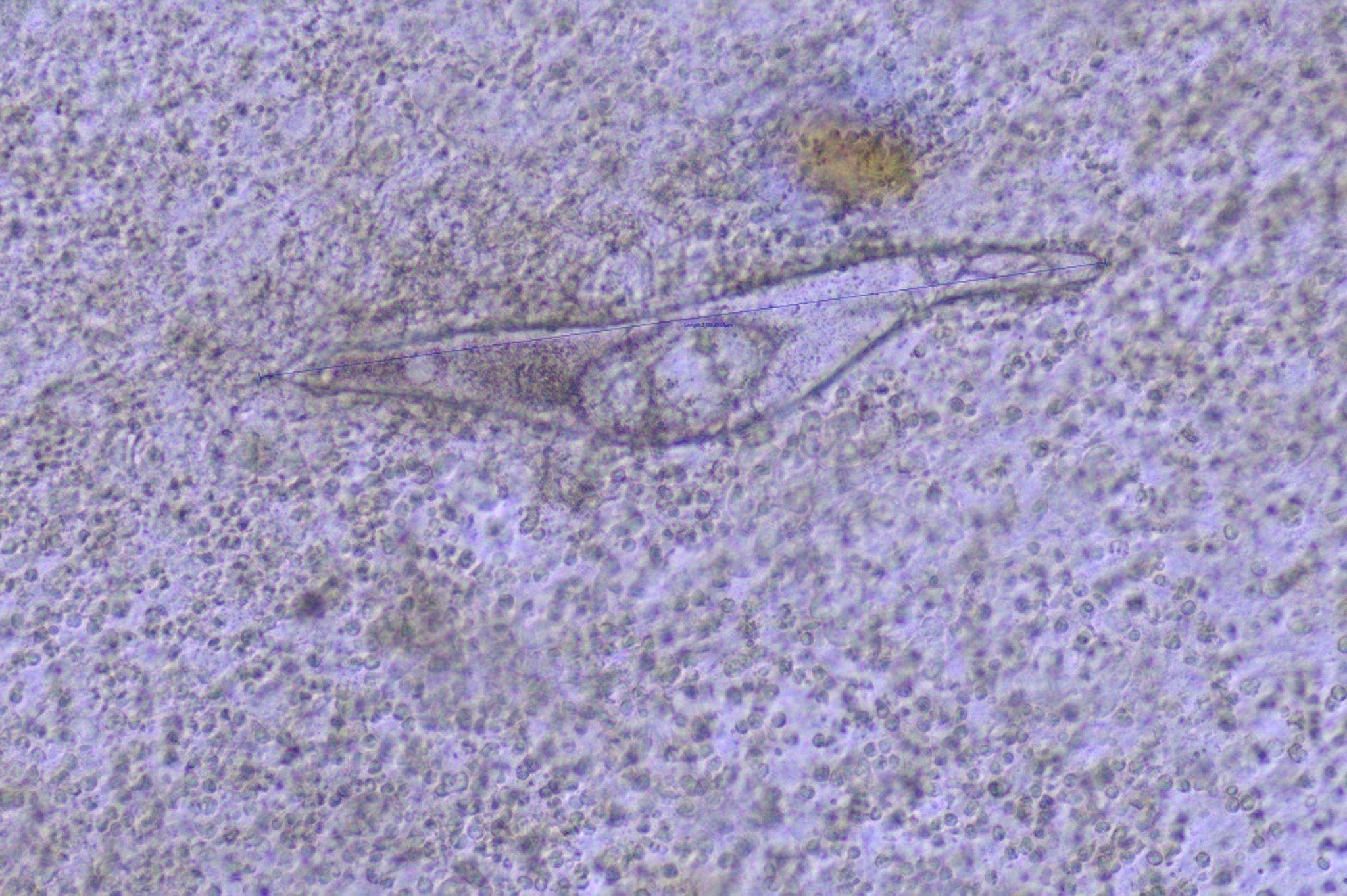 <i >Schistosoma nasale</i>
