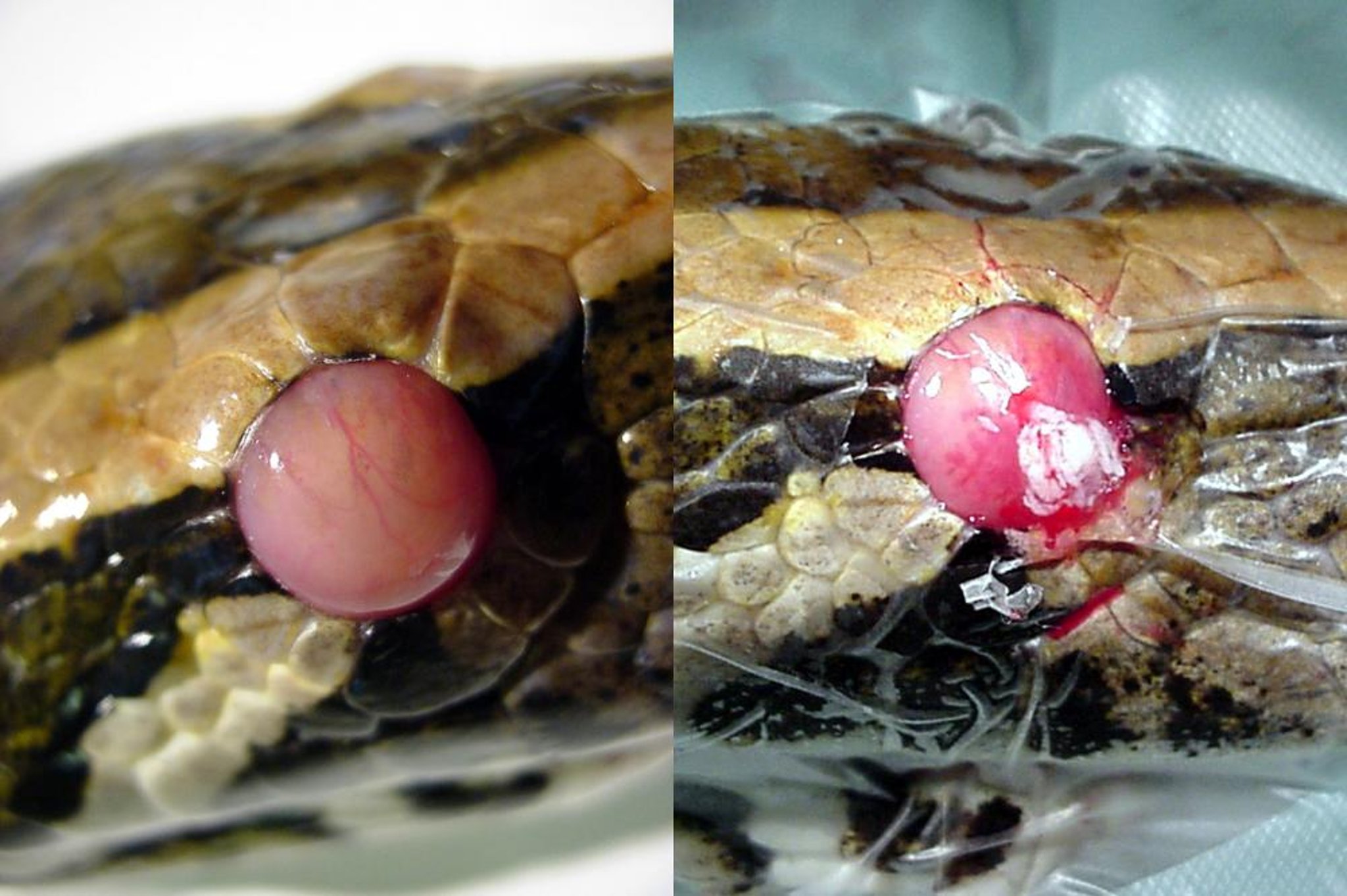 Subspectacle abscessation, snake