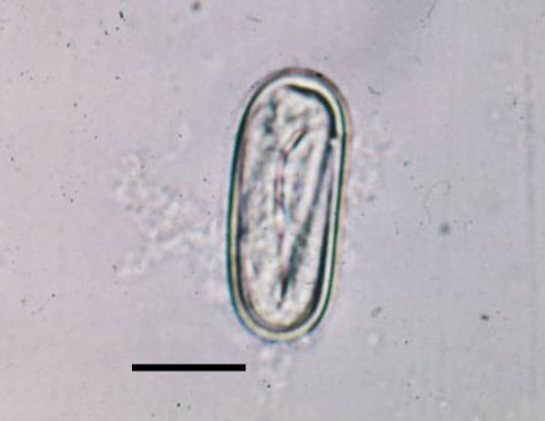 Egg,<i > Spirocerca lupi</i>, dog