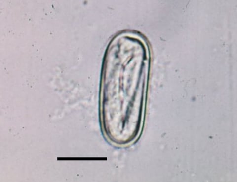 Spirocerca lupi in Small Animals - Digestive System - Merck Veterinary ...