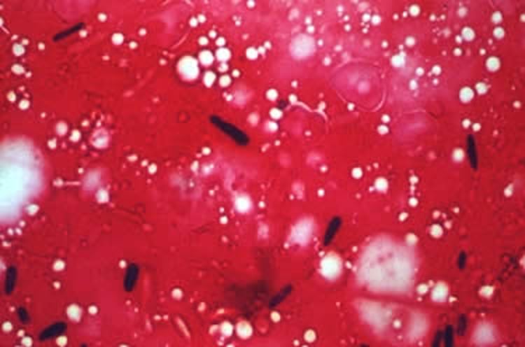 <i >Sporothrix schenckii</i>, tissue smear