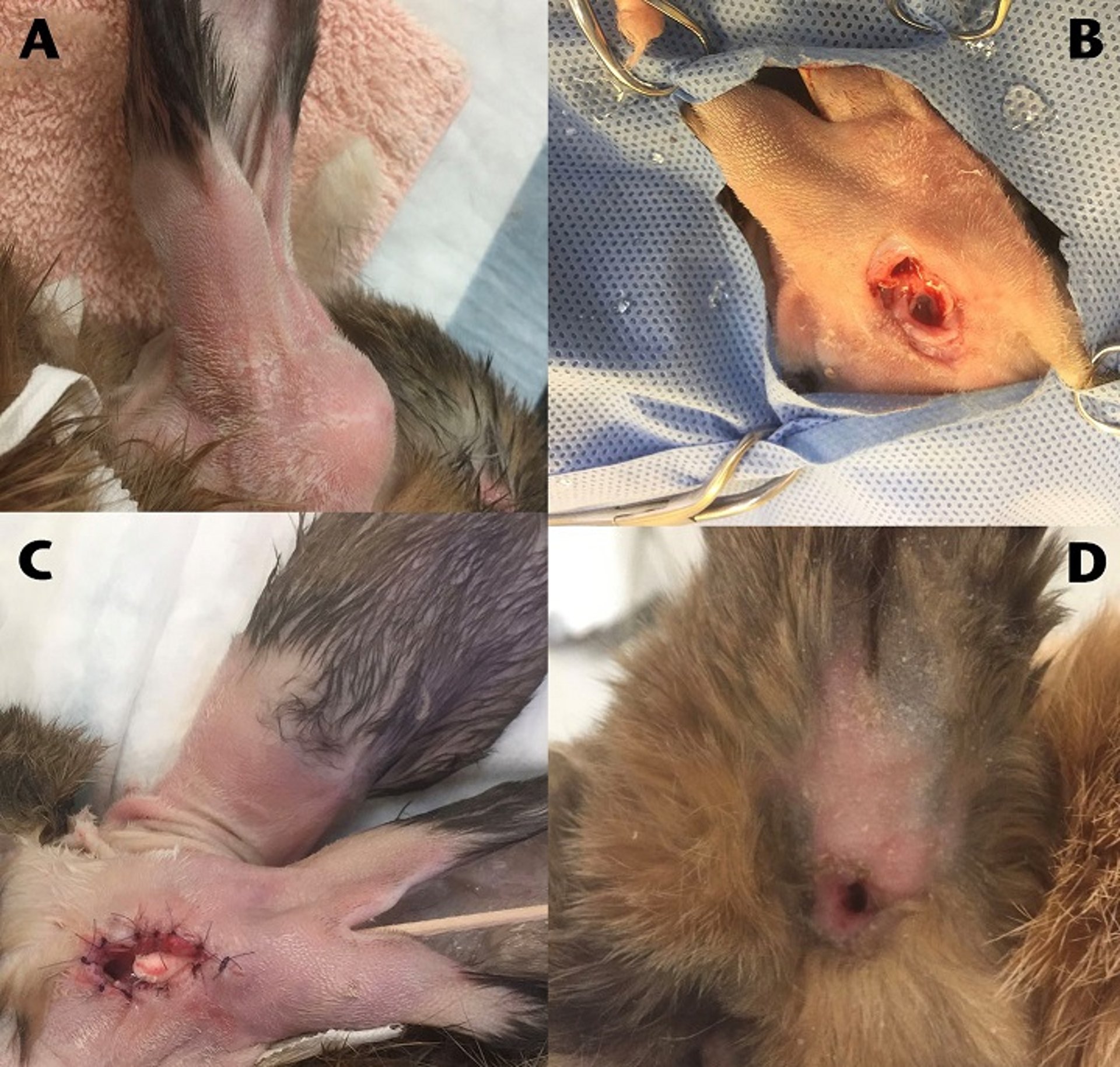 Stoma surgery for otitis externa