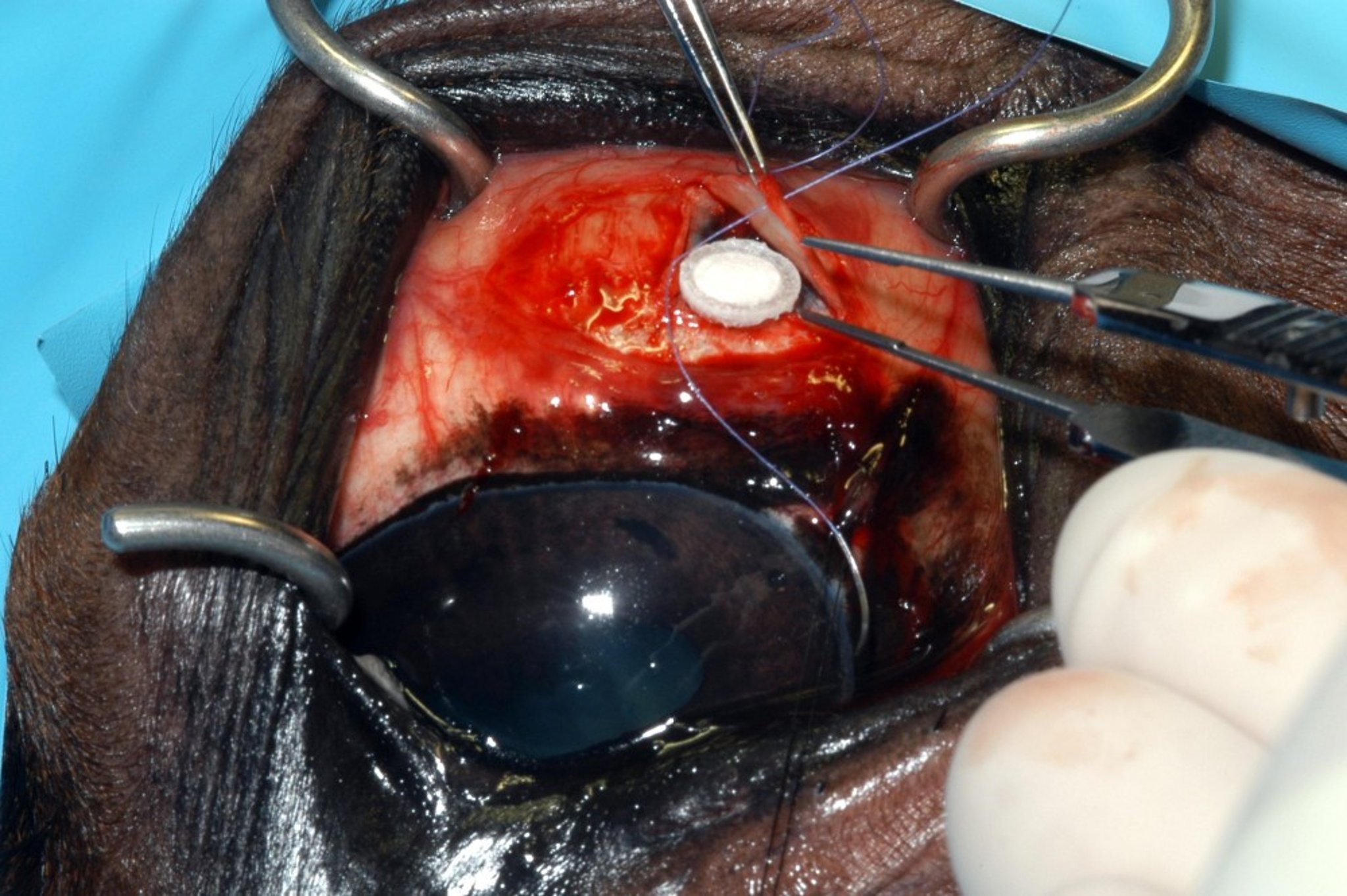 Suprachoroidal cyclosporine implant, horse