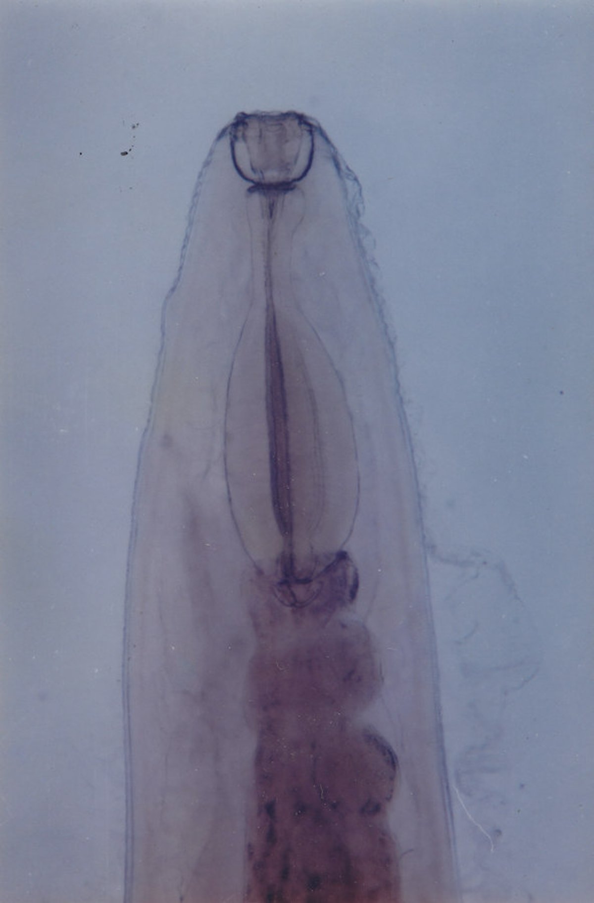Swine kidney worm, cranial end