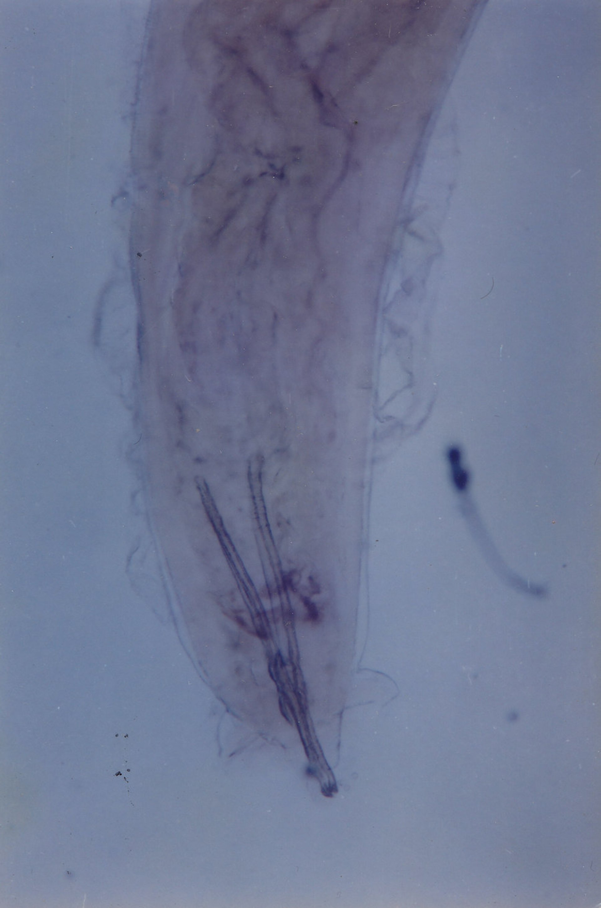Swine kidney worm, caudal end