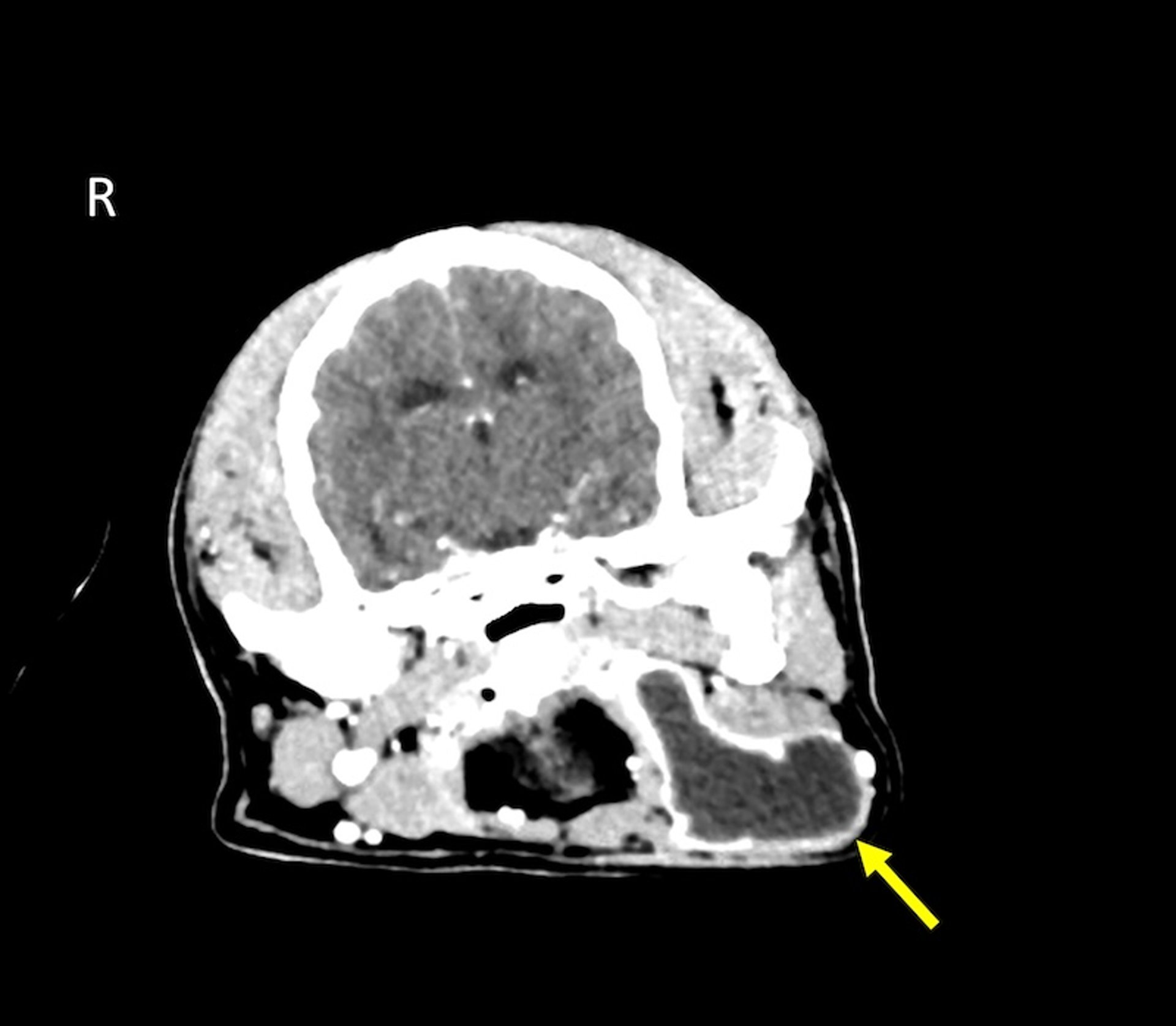 Salivary mucocele CT, dog