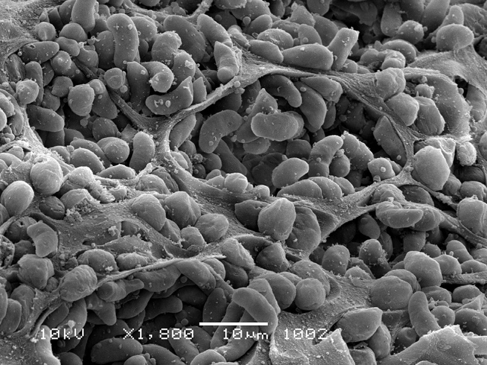 <i >Sarcocystis aucheniae</i> cyst, scanning electron micrograph