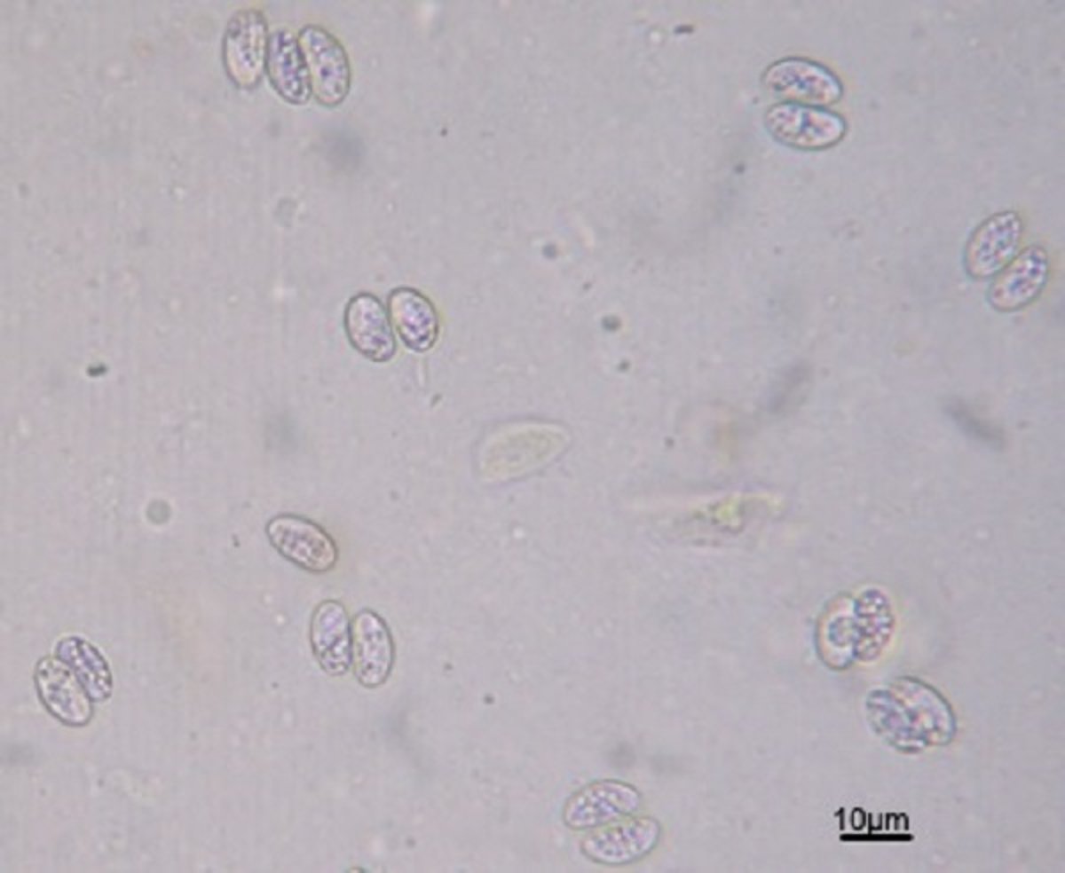 <i >Sarcocystis</i> sp oocysts and sporocysts, sugar flotation, photomicrograph