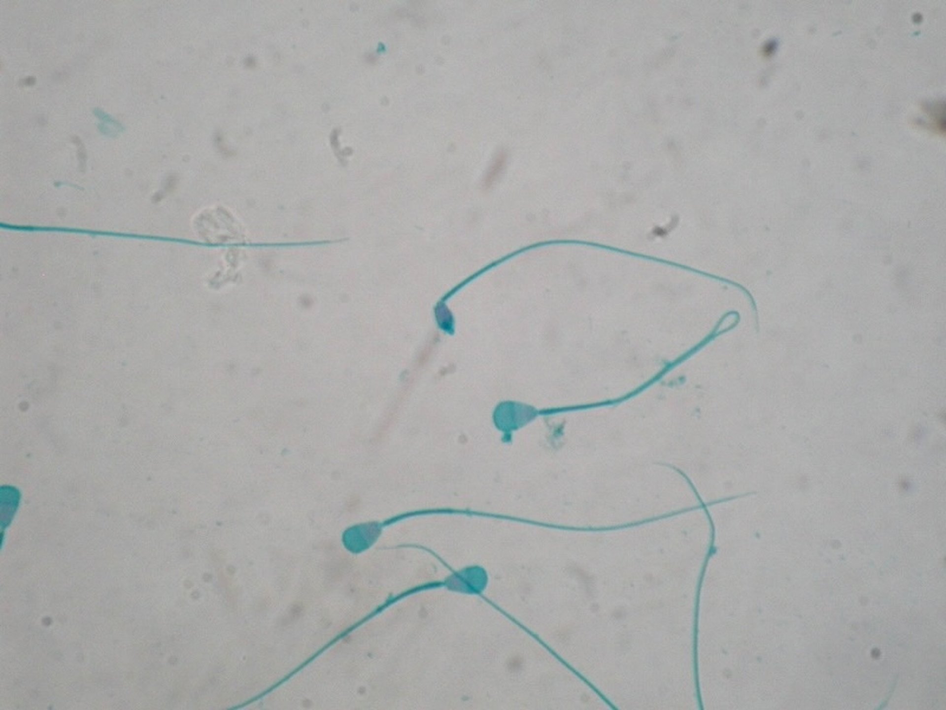 Semen, microcephalic sperm, dog