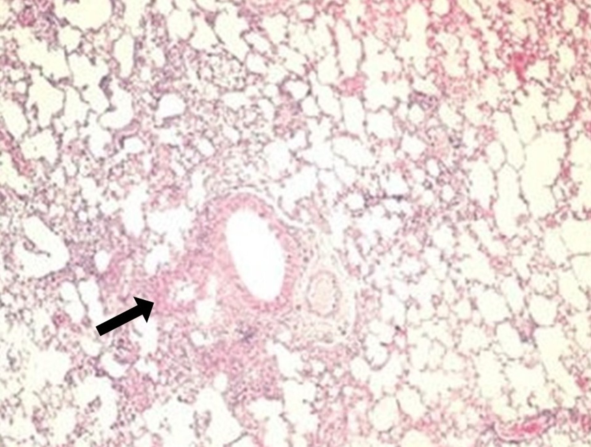 Sendai virus infection, peribronchiolar inflammation, rat, photomicrograph
