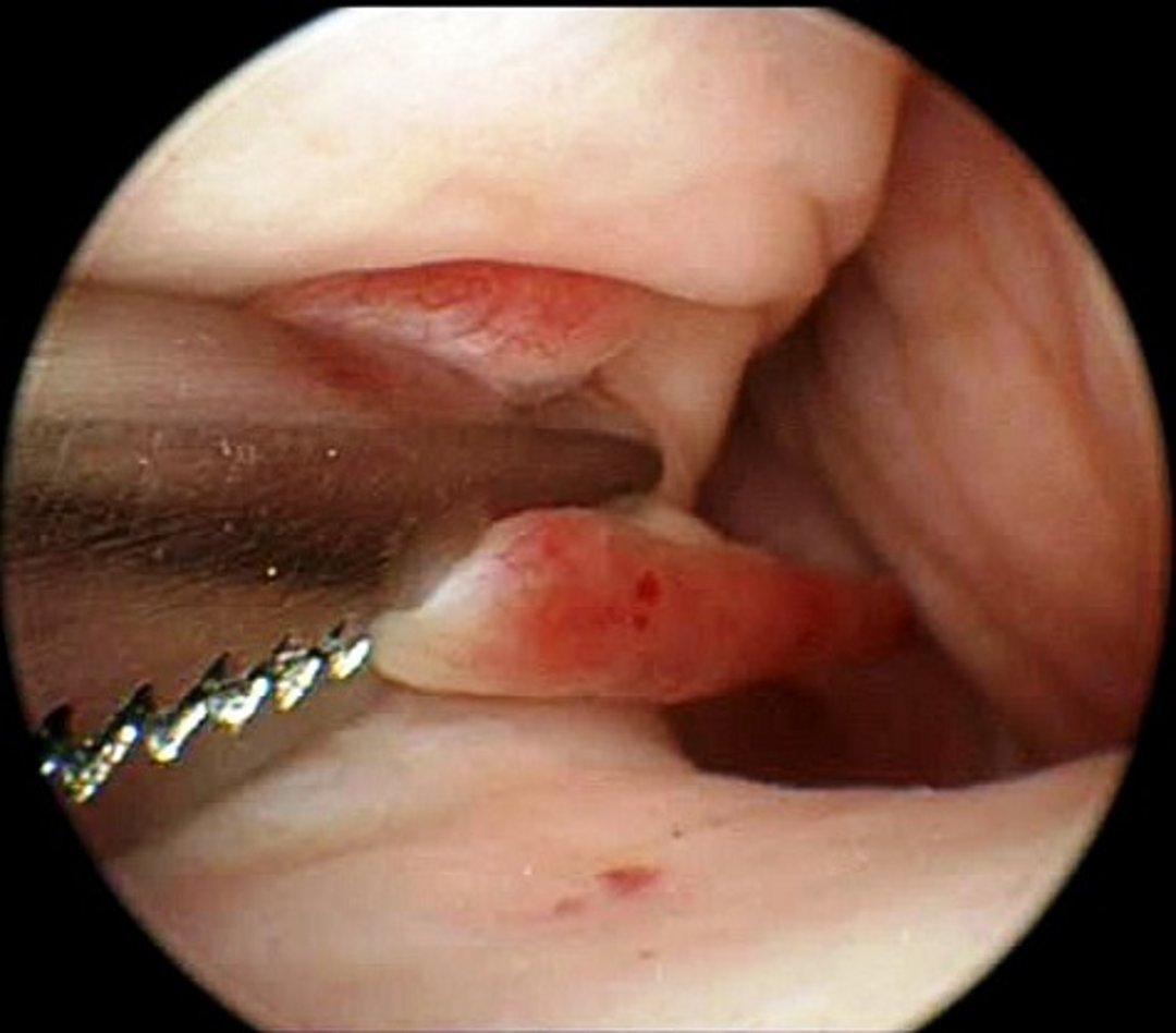 Revisão da faixa vaginal septada, vaginoscopia, cadela