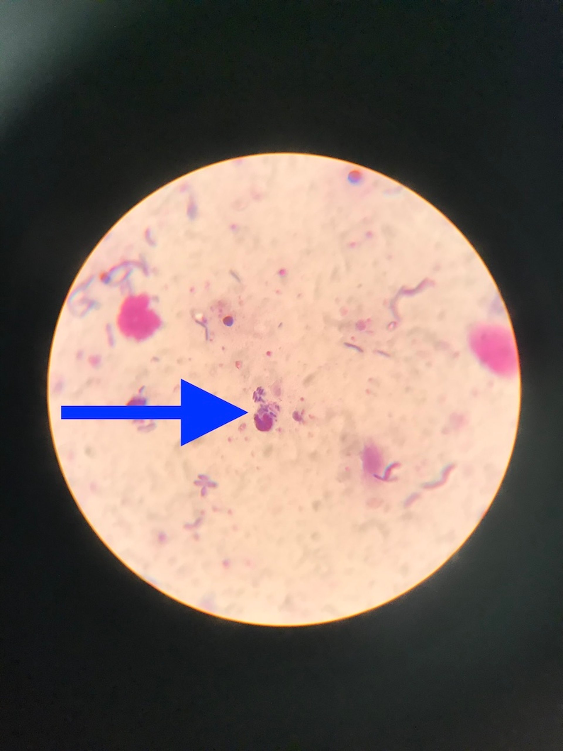 Derrame abdominal séptico, fotomicrografia, cão