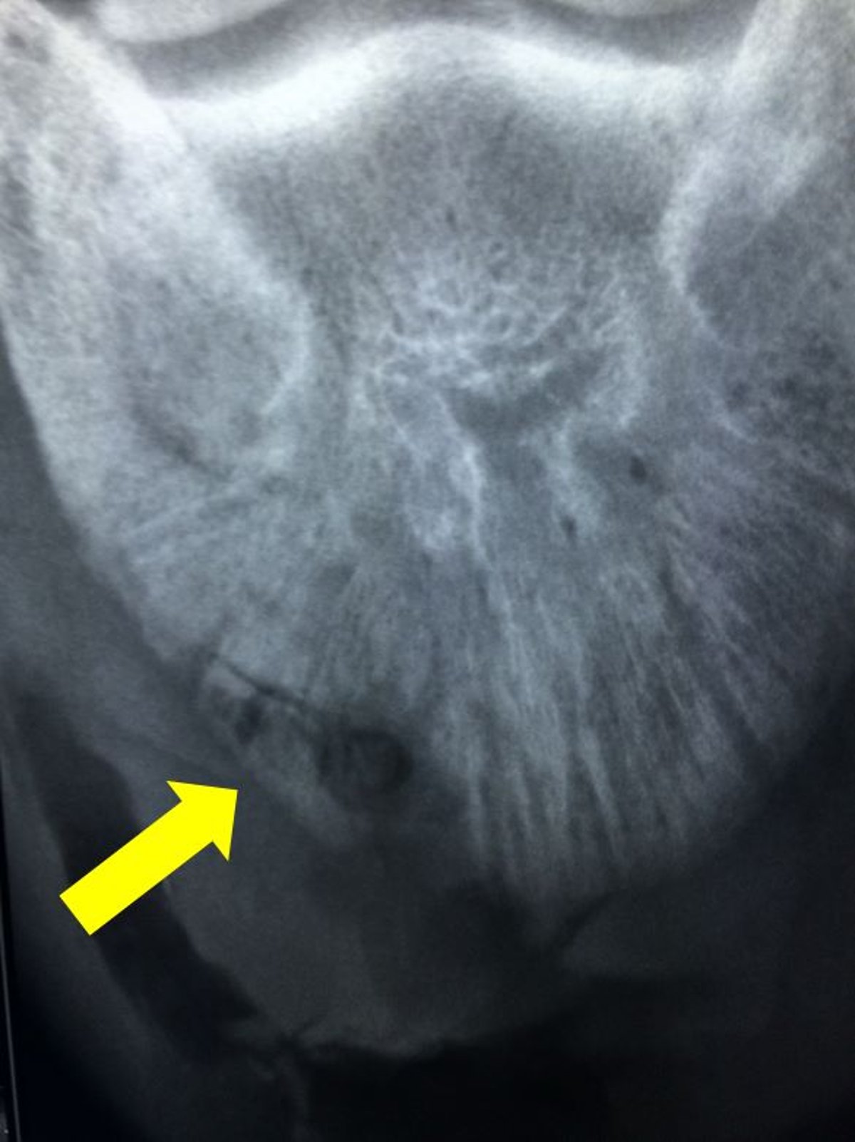 Sequestrum, distal phalanx, radiograph, horse