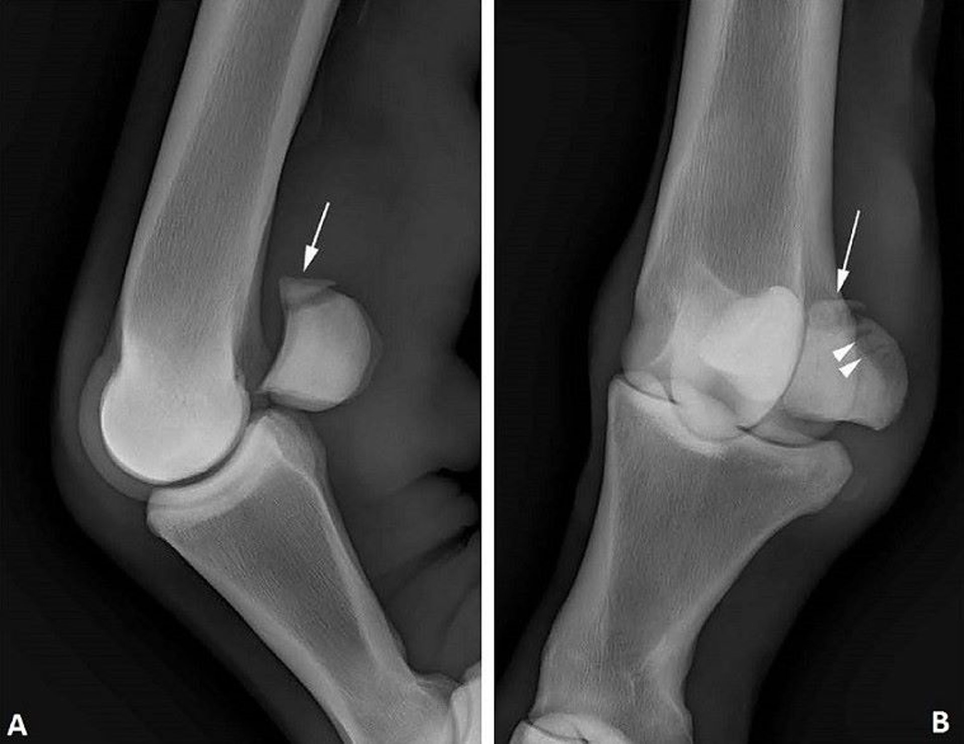 Sesamoid bone apical fracture radiographs, horse