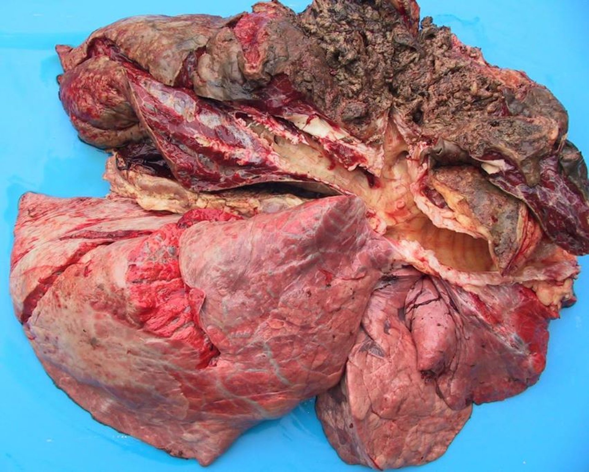 Severe chronic necrotizing pneumonia, lung tissue, cow