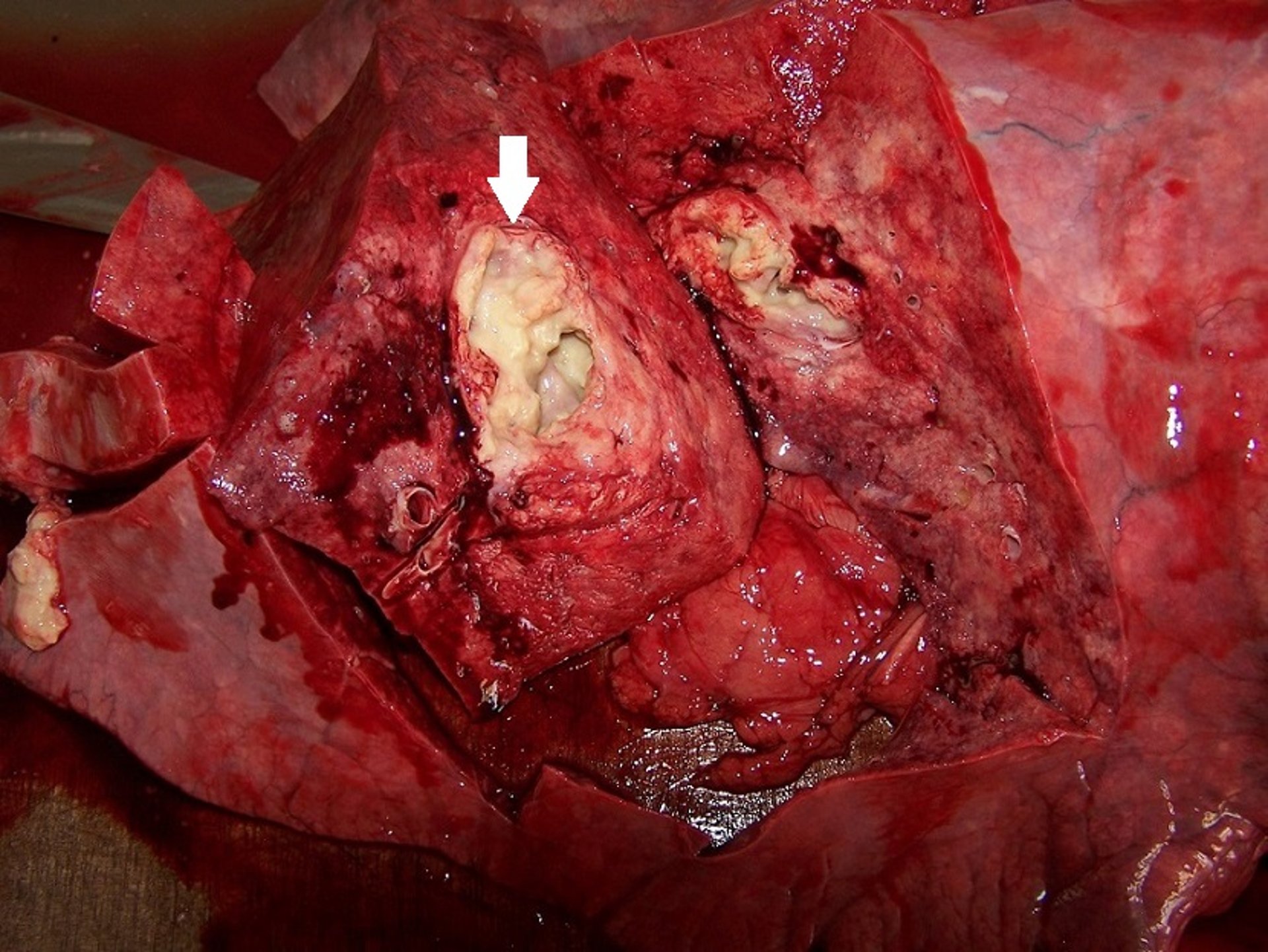 Neumonía grave por <i >Rhodococcus equi</i>, potros