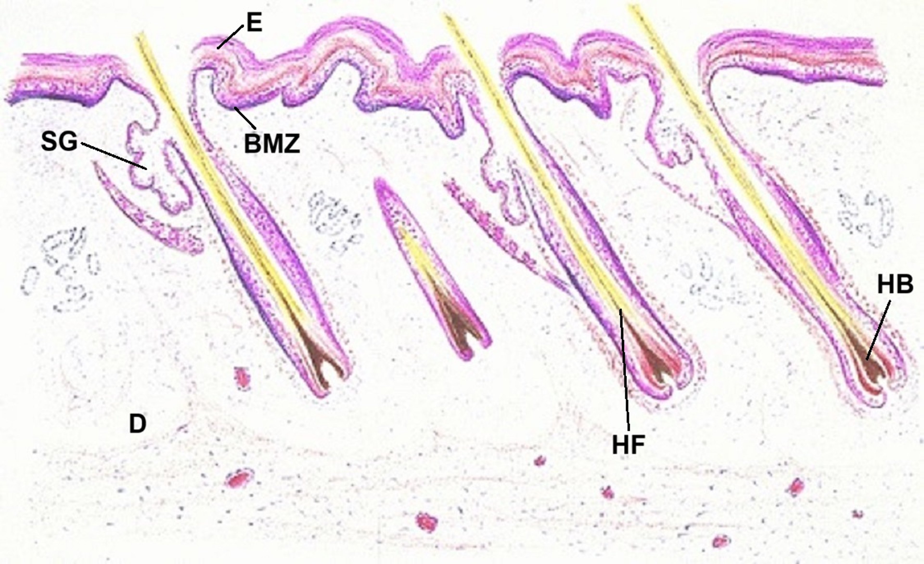 Skin with hair