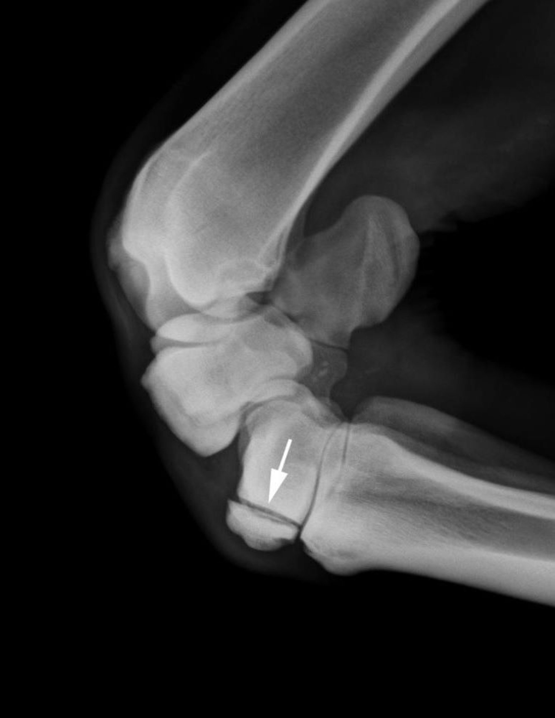 Slab fracture, third carpal bone, radiograph, horse
